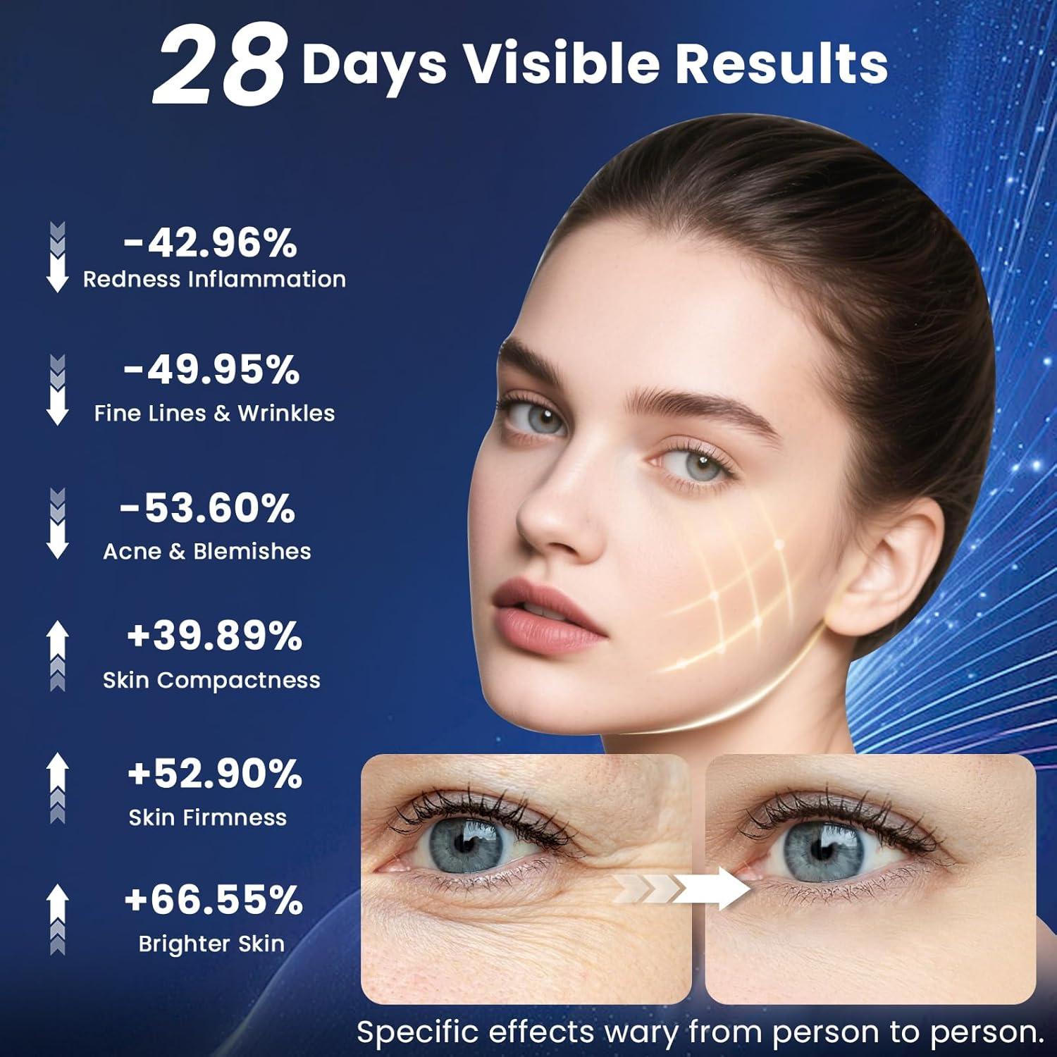 Máscara de Terapia de Luz Roja Inalámbrica Lovsheme 320 LEDs