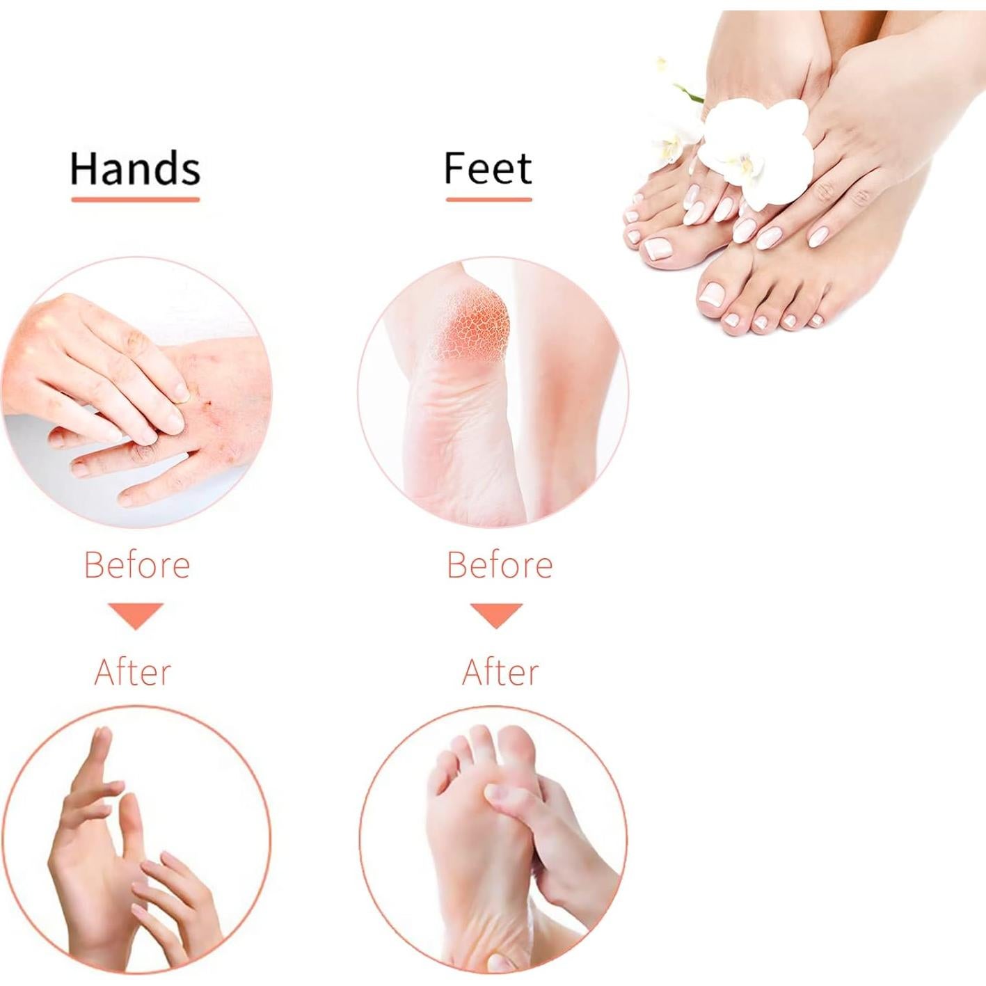 Forros desechables para terapia de parafina Charmyth 100 unidades