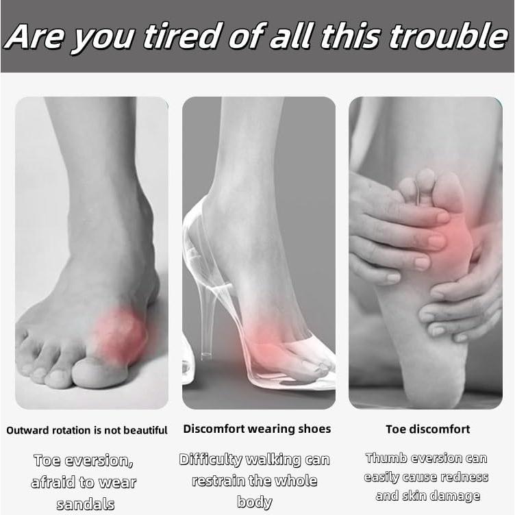 Corrector de Juanetes Peak con Separadores de Silicona - 2 Pcs