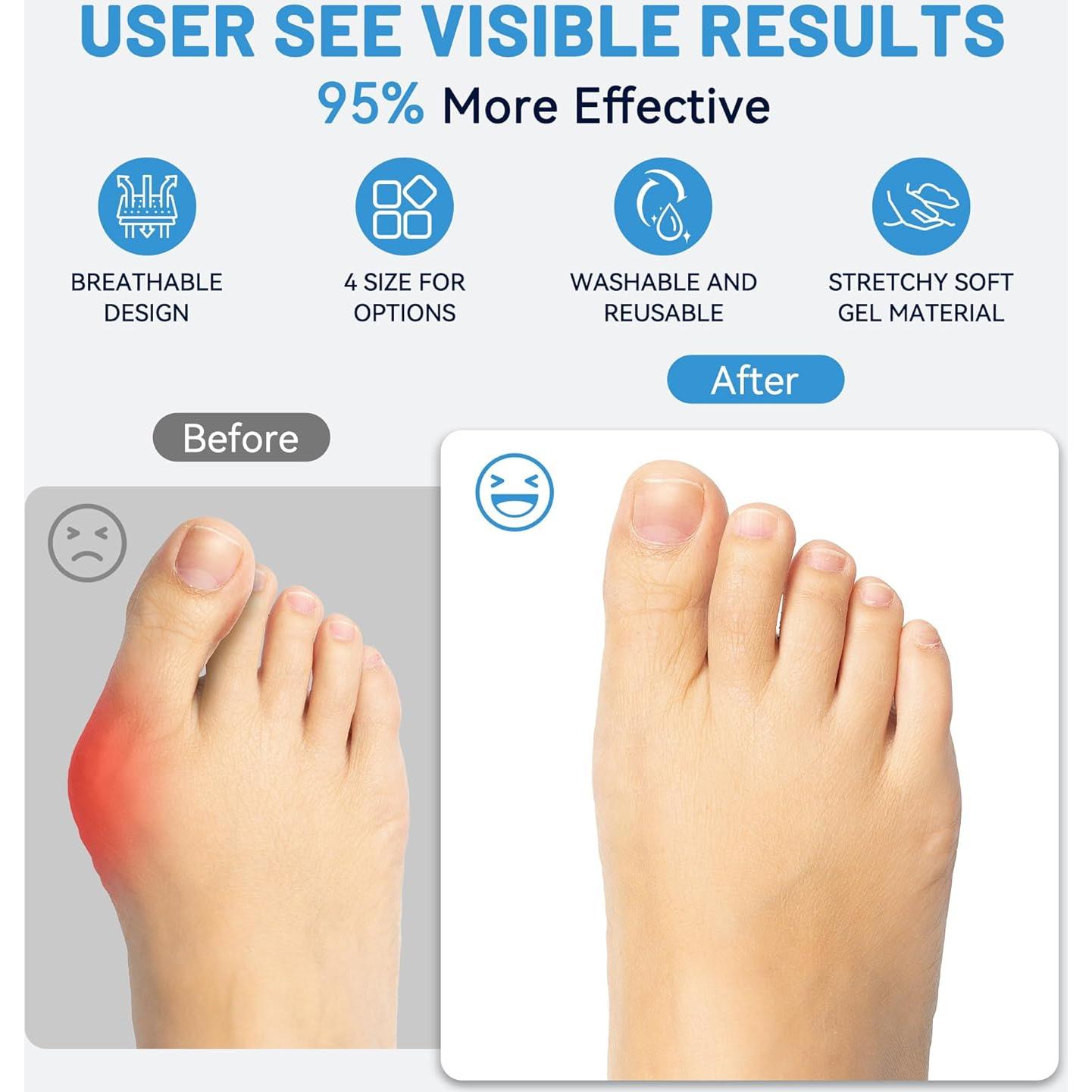 Manga para juanete LEOWEER con gel y ajuste antideslizante