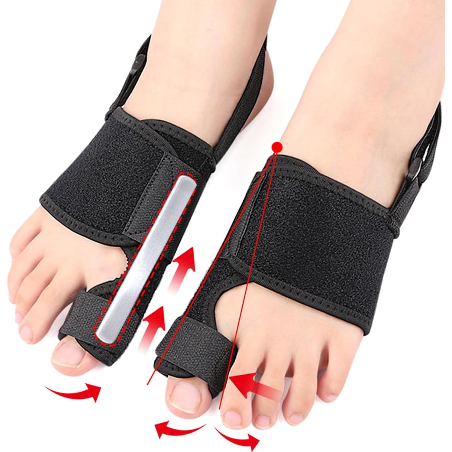 2 Correctores de Juanetes Lonicerkz para Alivio de Hallux Valgus