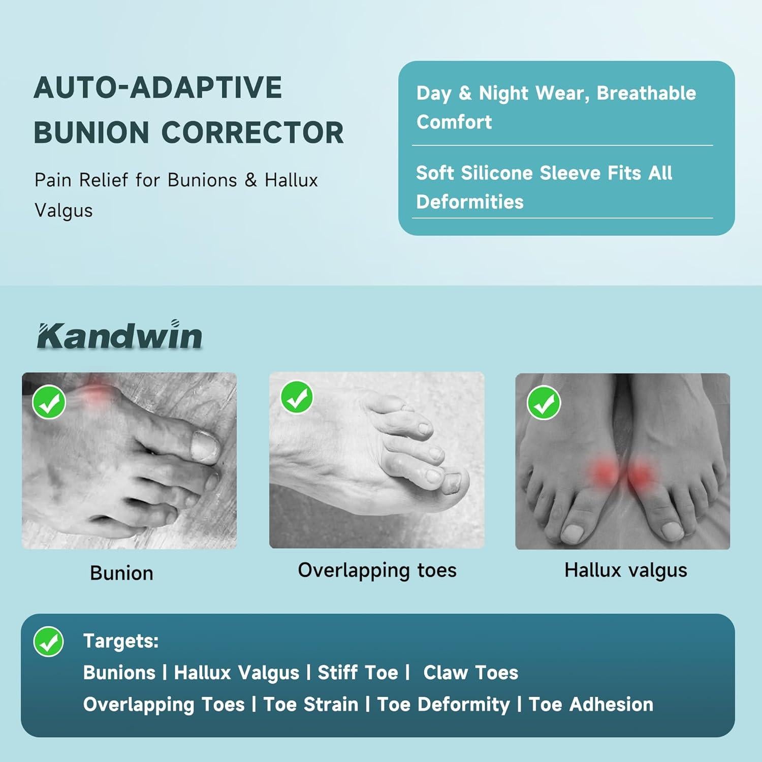 Corrector de Juanetes Kandwin BC-01-B para Alivio del Dolor