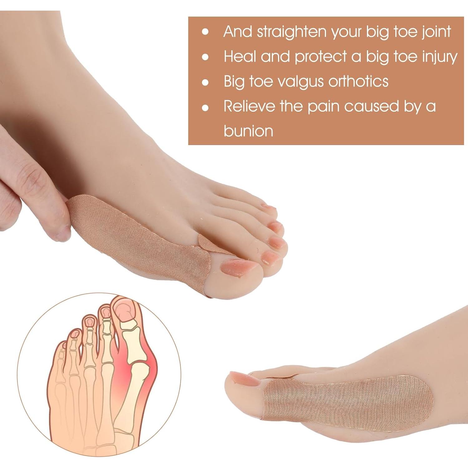 50 Correctores de Juanetes Qianyu para Dedo Gordo - Alivio Dolor