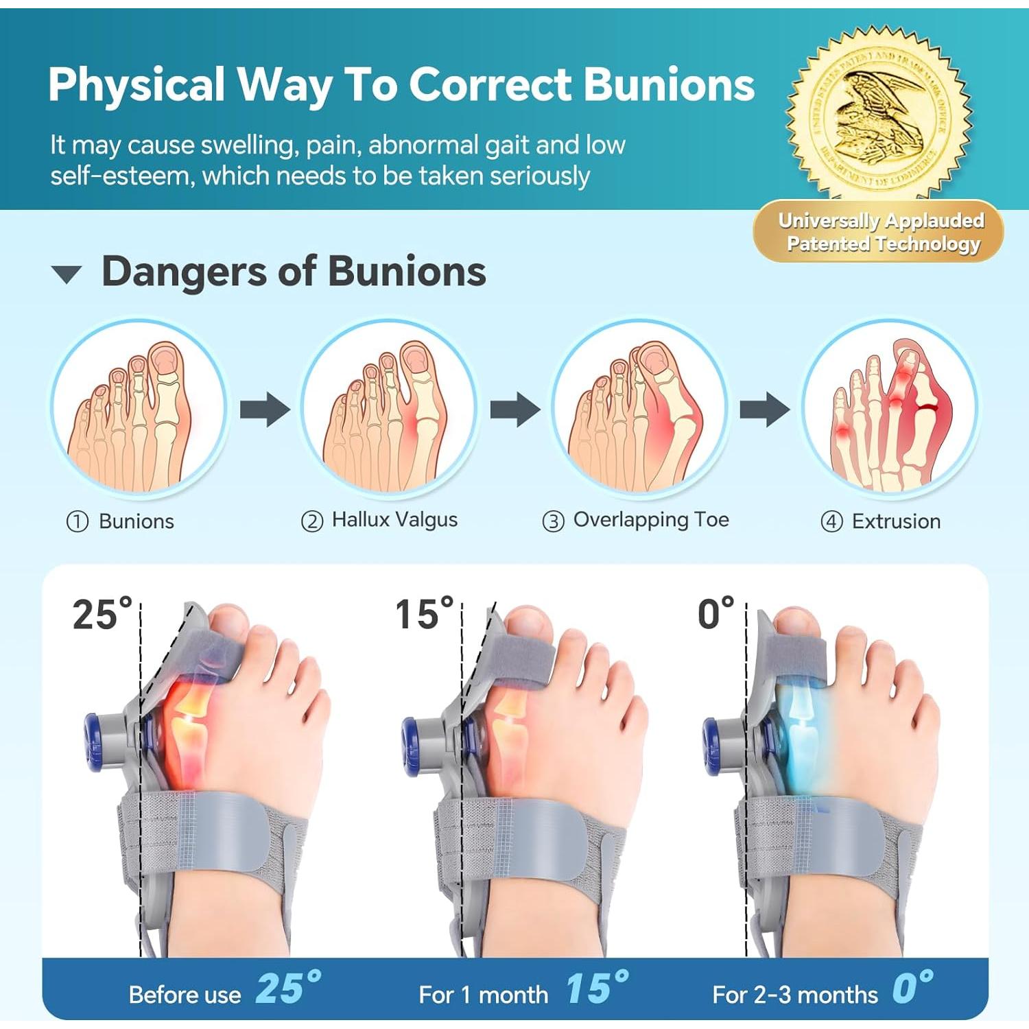 Corrector de Juanetes WOLOYHEATIE Ajustable para Alivio del Dolor