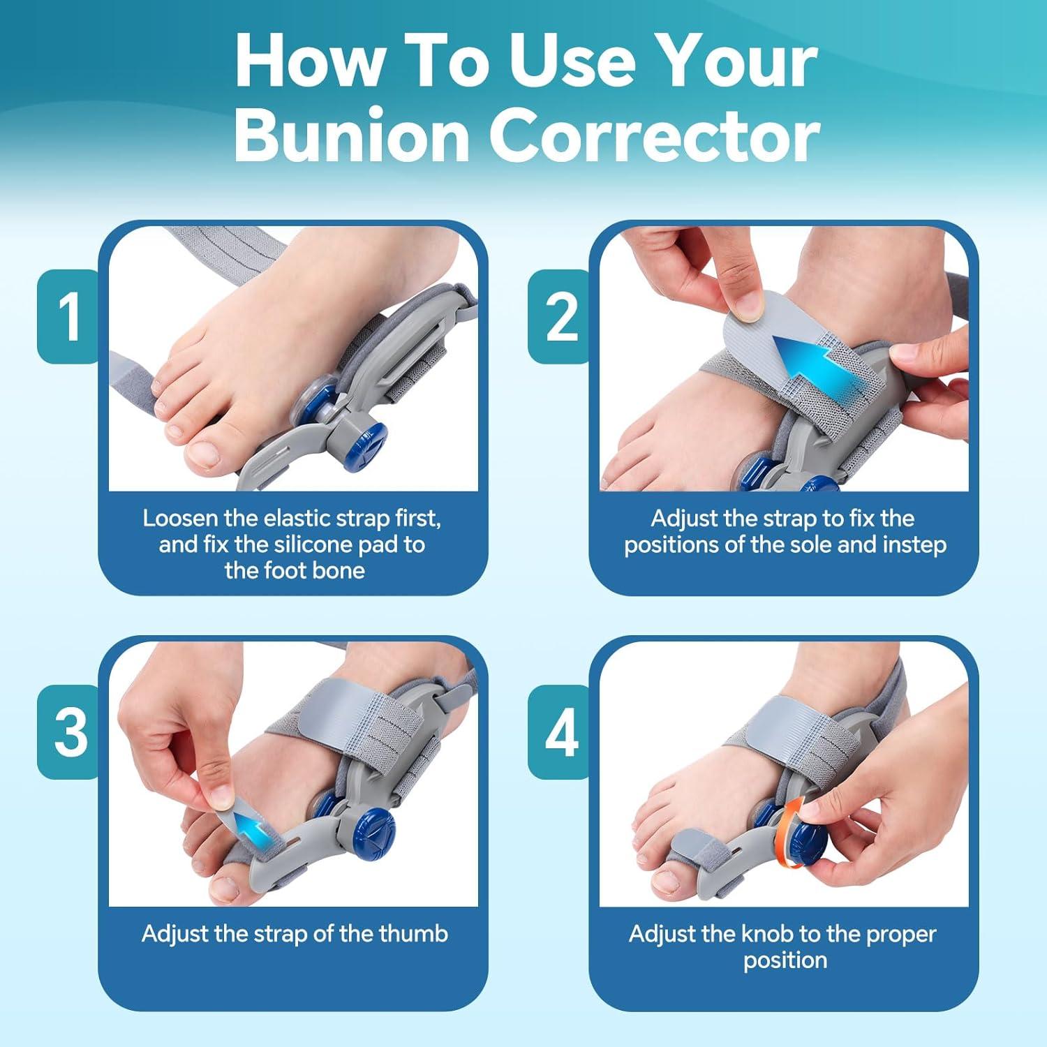 Corrector de Juanetes WOLOYHEATIE Ajustable para Alivio del Dolor