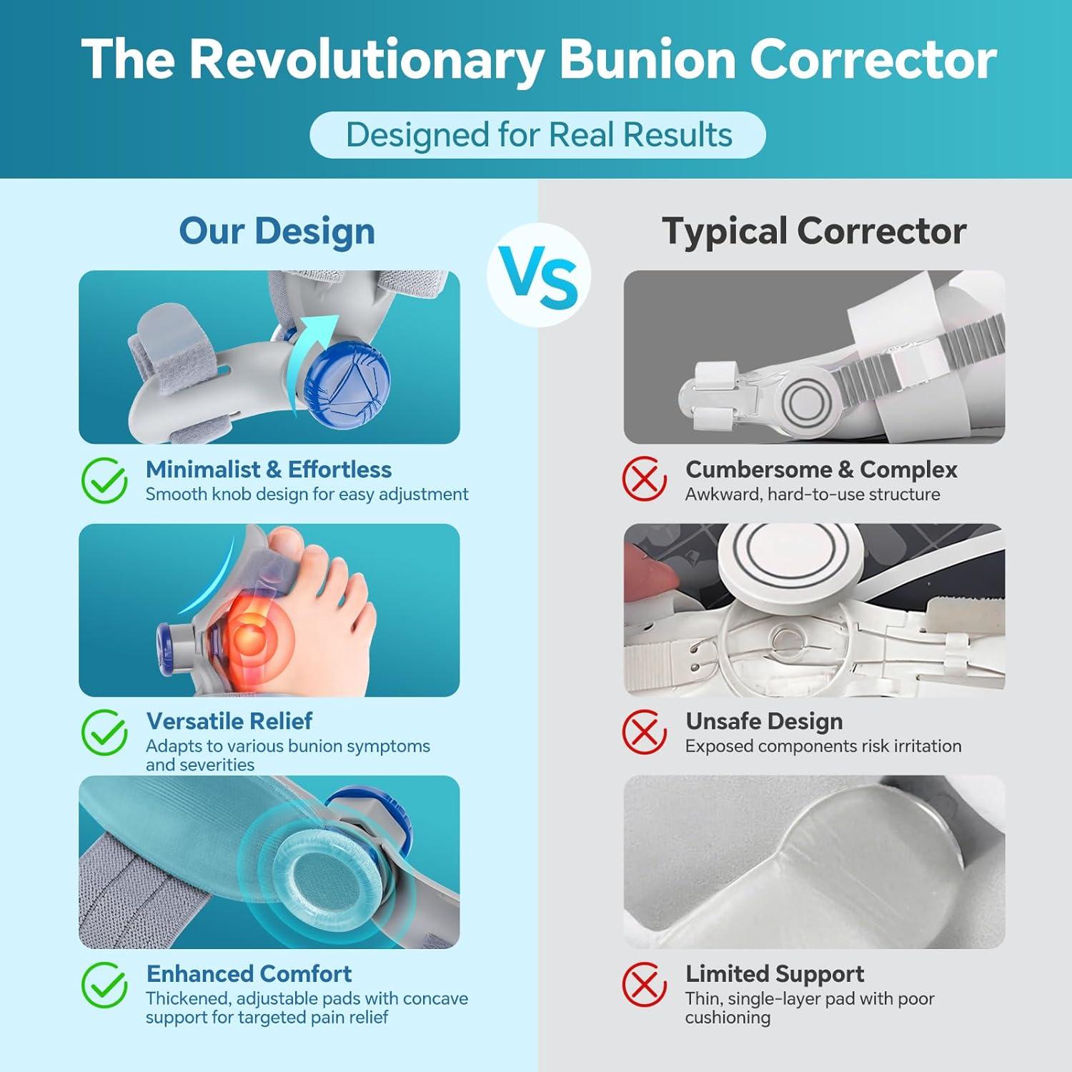 Corrector de Juanetes WOLOYHEATIE Ajustable para Alivio del Dolor