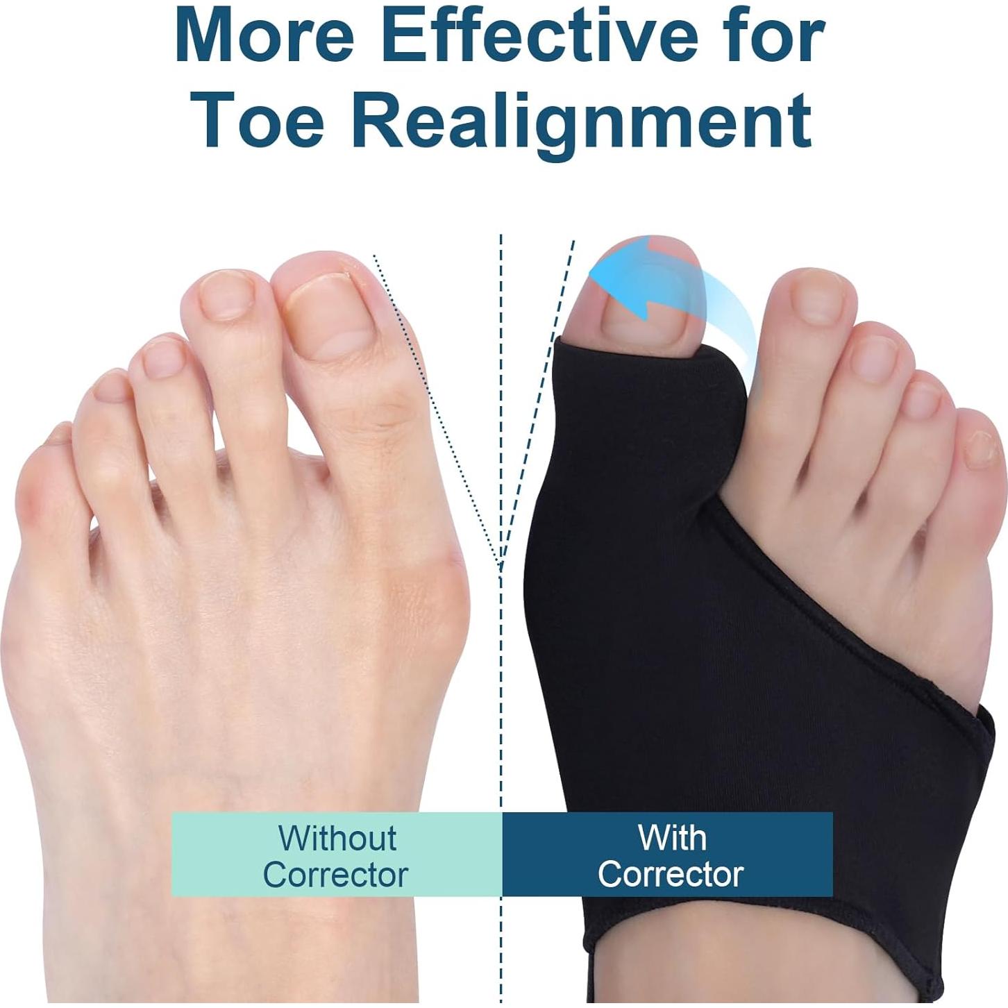 Corrector de Juanetes Mageeh para Mujeres y Hombres - Alivio Dolor Hallux Valgus