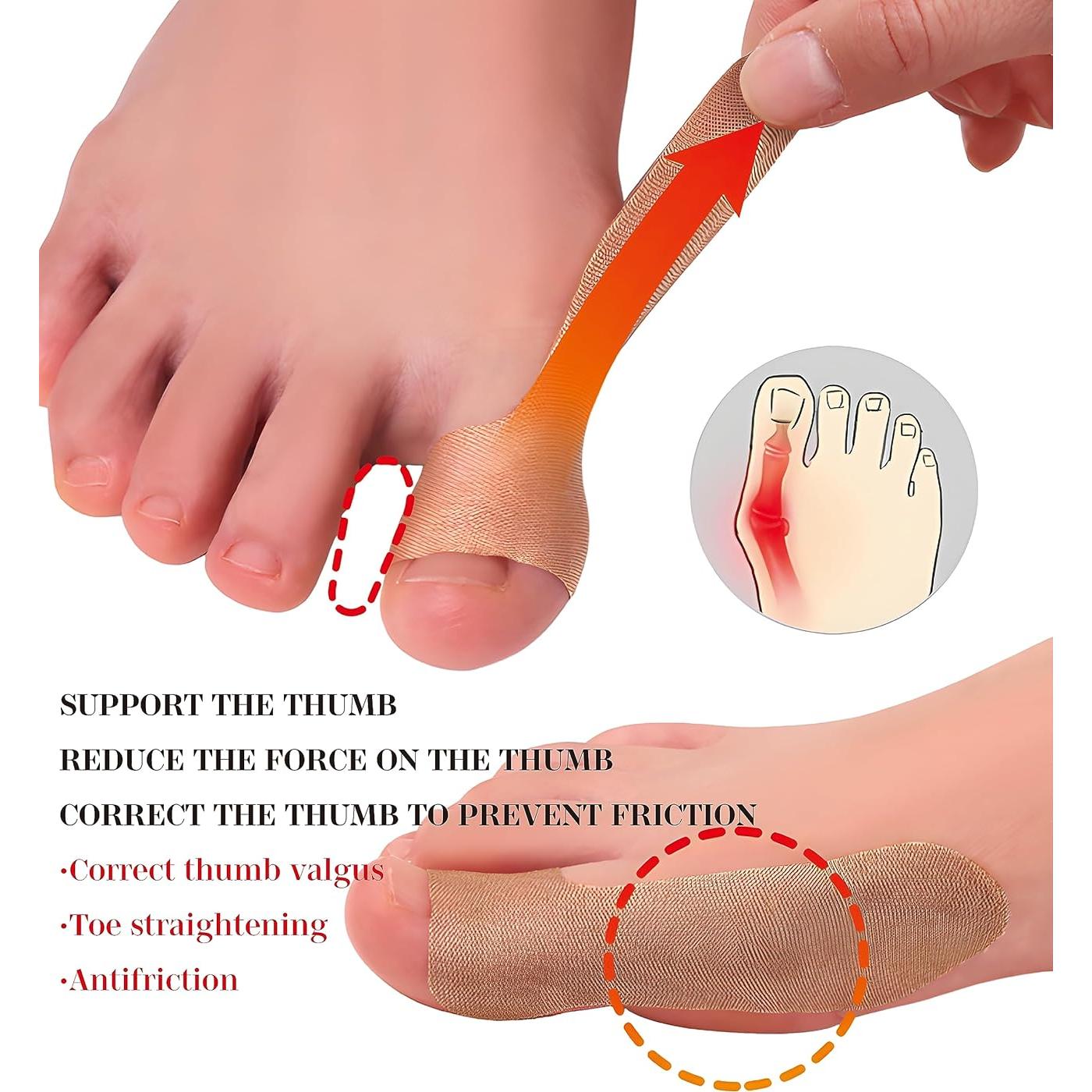 Corrector de Juanetes BLacOh 20 PCS Soporte Dedo Gordo