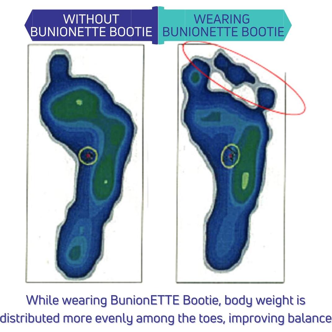 Botín Corrector de Juanetes BunionETTE Mediana Derecha