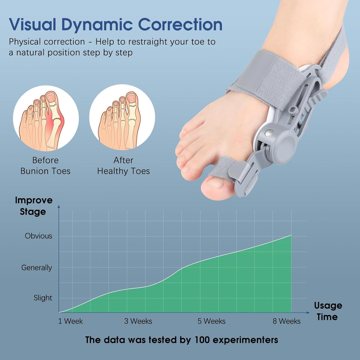 Corrector de Juanetes KASHEVI Ajustable para Alivio del Dolor