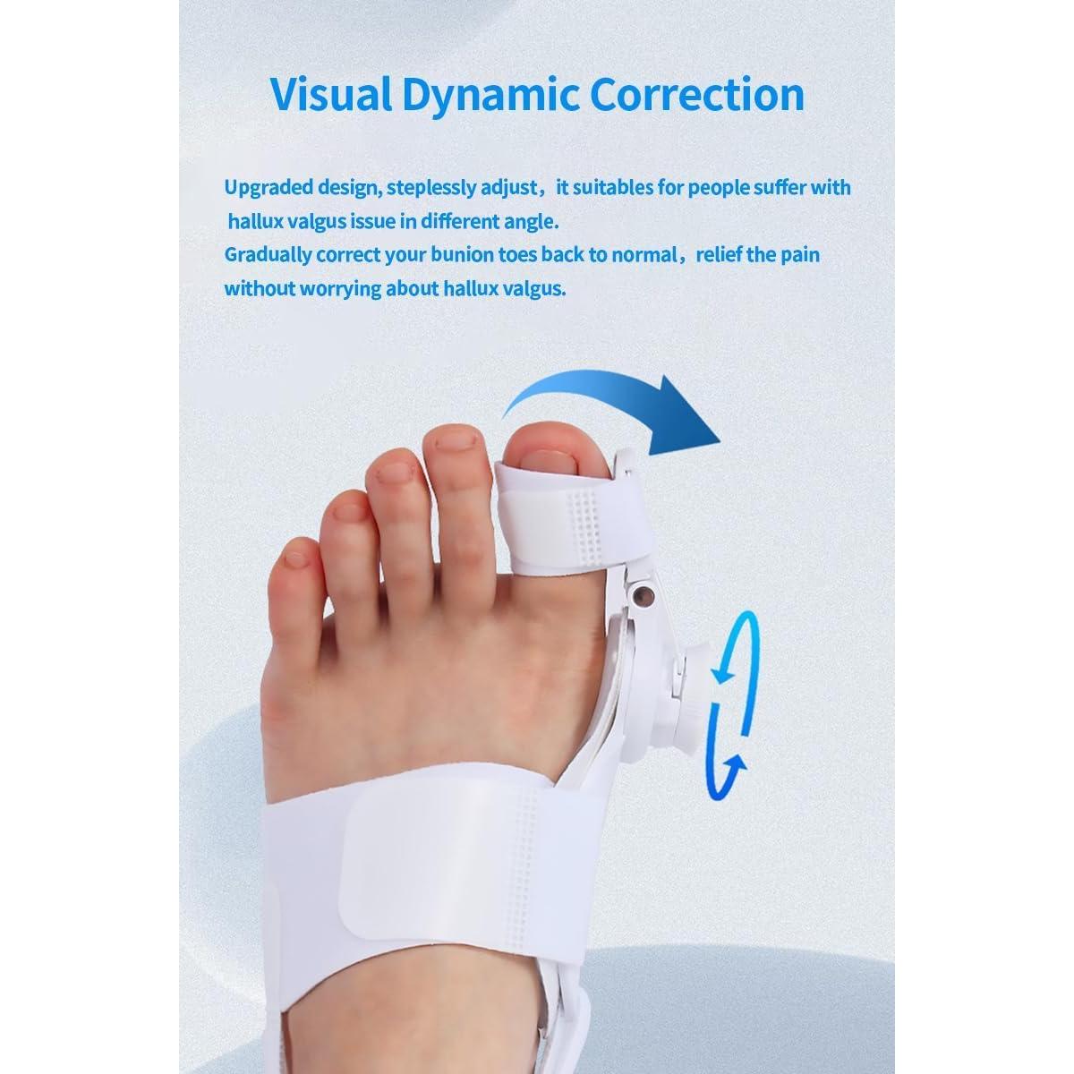 Corrector de Juanetes Ajustable XREKNOi Modelo 02 para Alivio