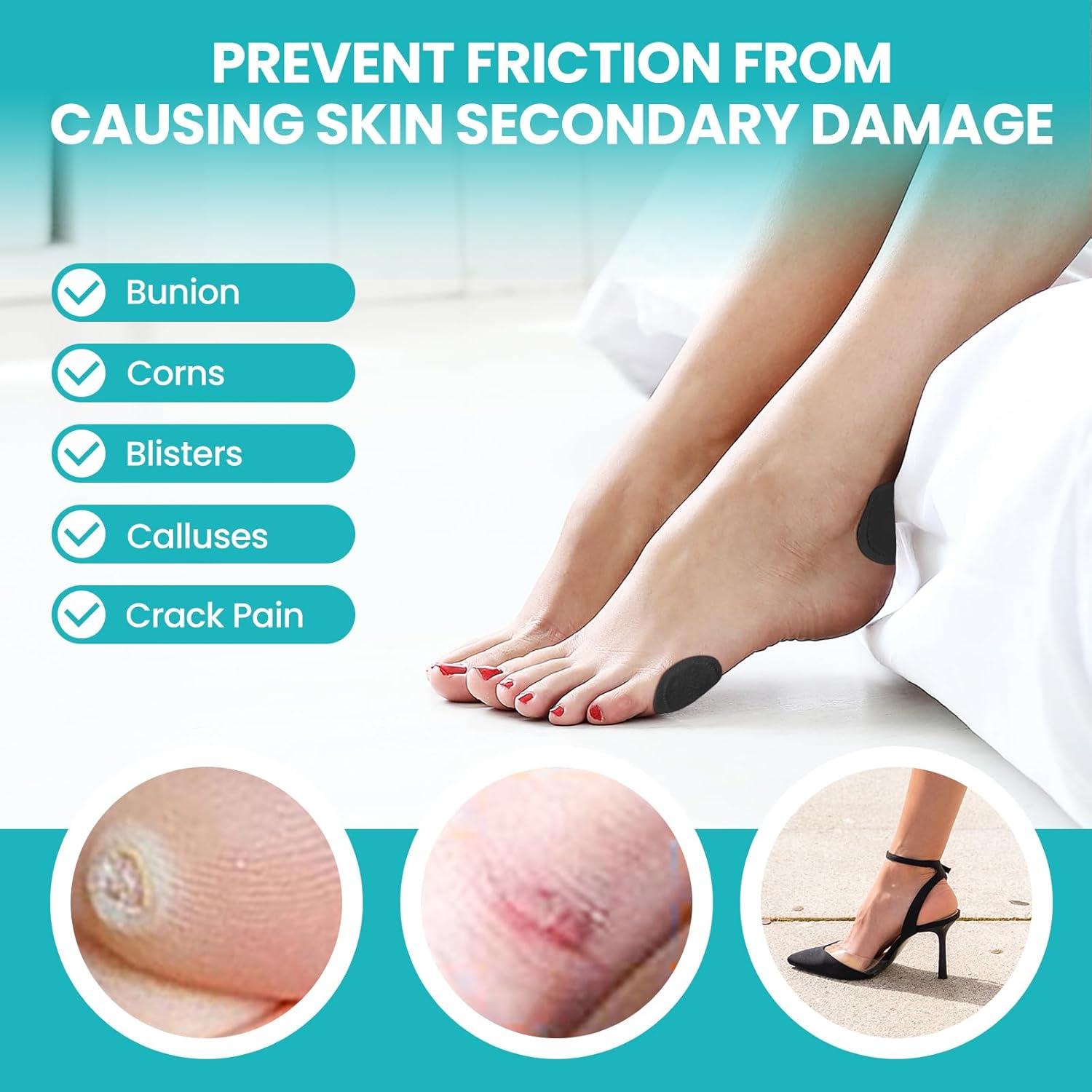 Almohadillas para Juanetes Promifun - 27 Cojines Autoadhesivos