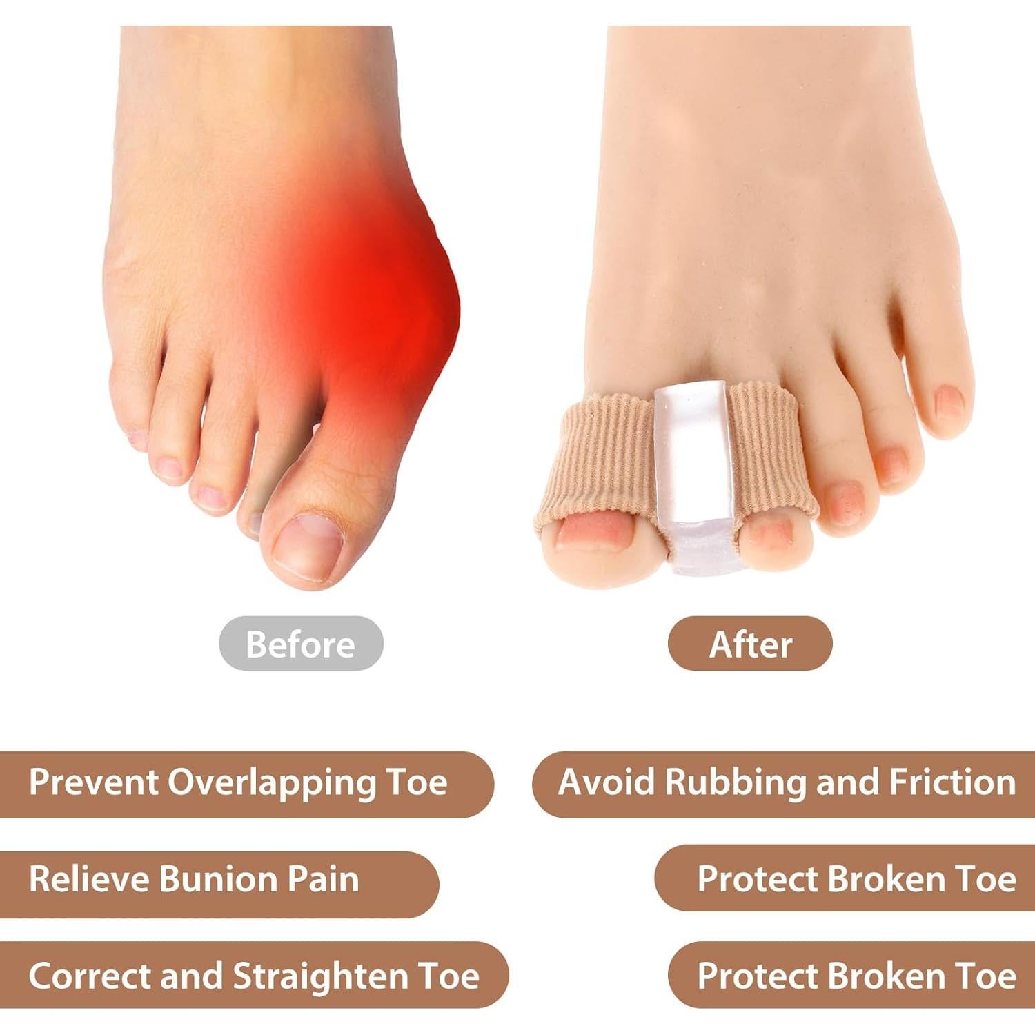 Separadores de Dedos de Gel Wanmu para Juanetes - 4 Pcs