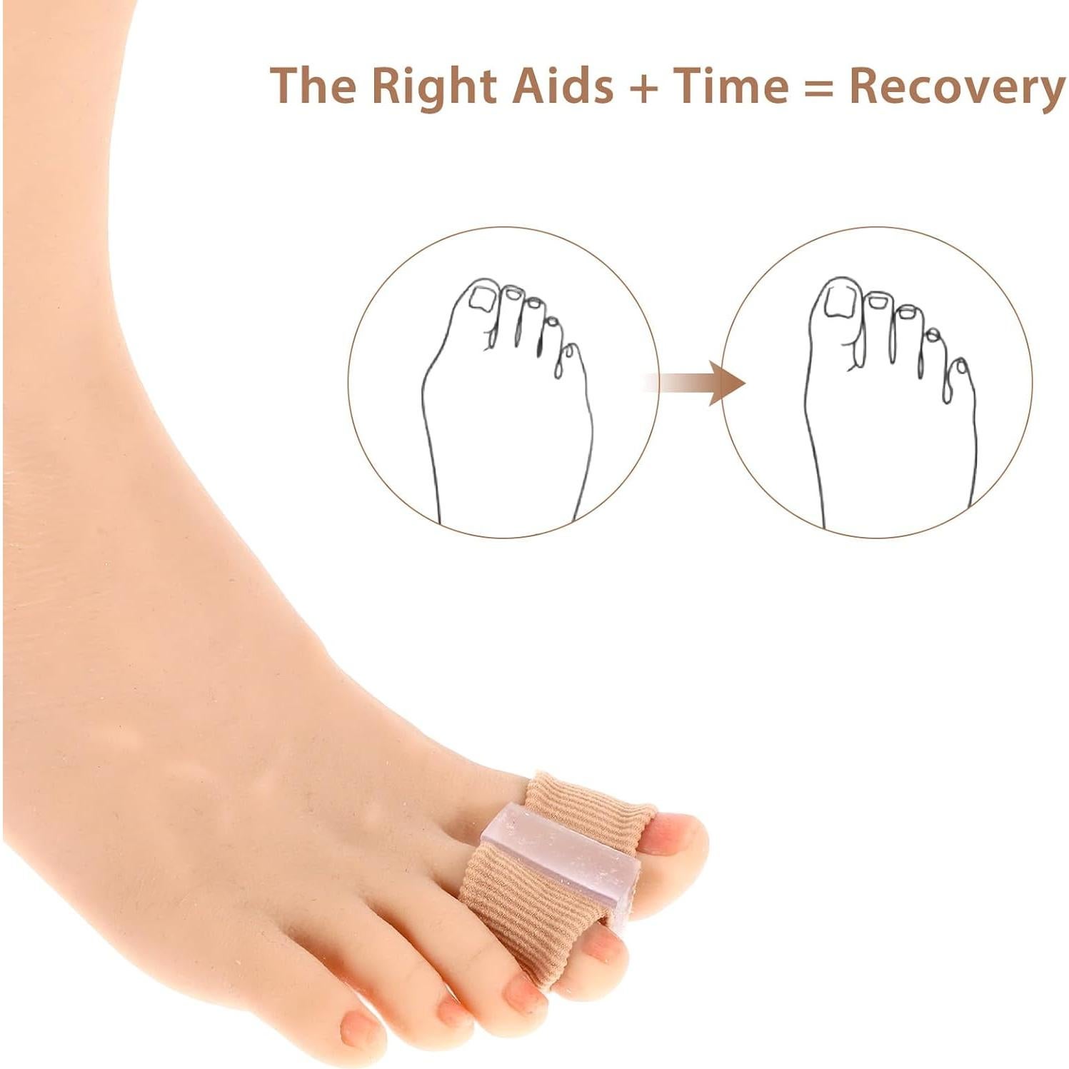 Separadores de Dedos de Gel Wanmu para Juanetes - 4 Pcs