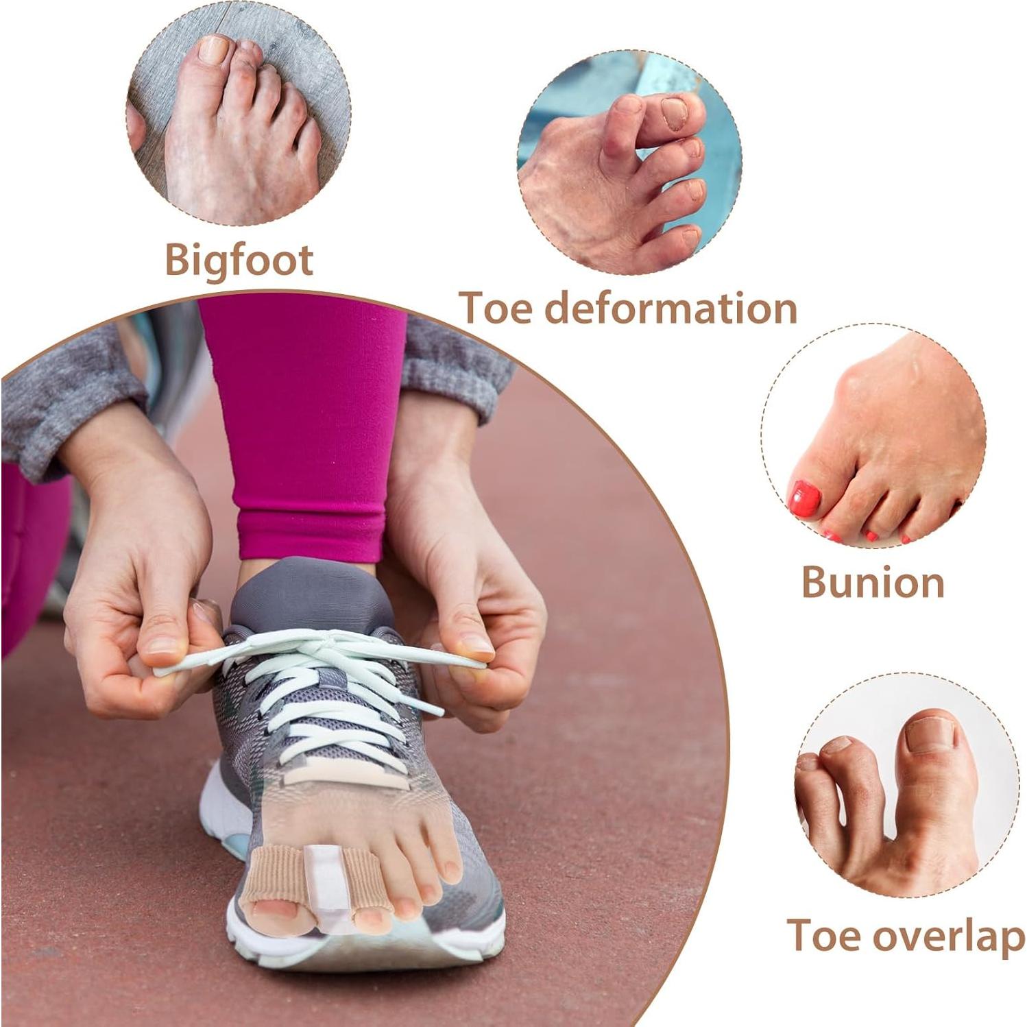 Separadores de Dedos de Gel Wanmu para Juanetes - 4 Pcs