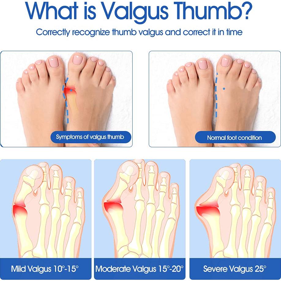 Corrector de Juanetes Heasoy con Separador de Dedos - 1 Par
