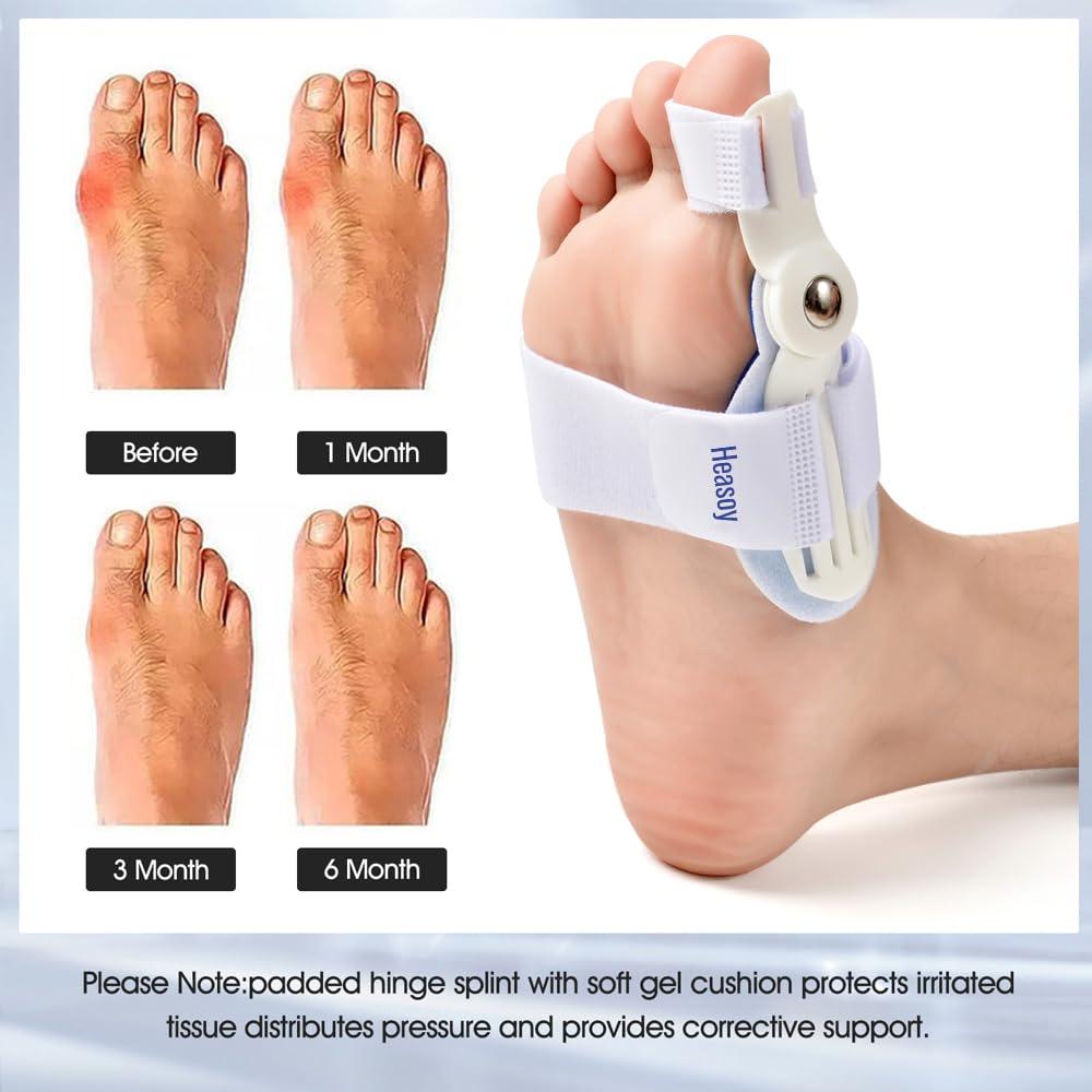 Corrector de Juanetes Heasoy con Separador de Dedos - 1 Par