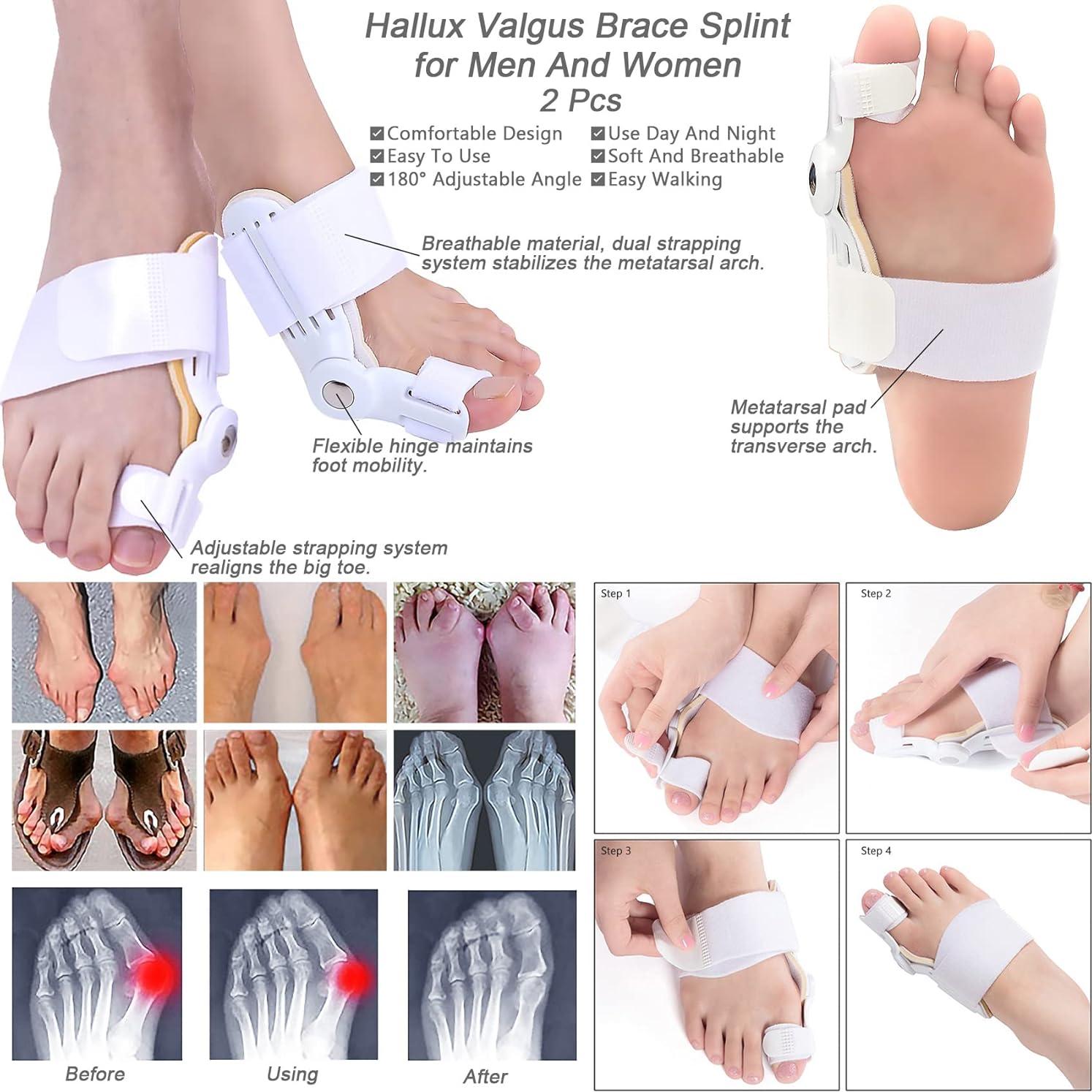 Kit Corrector de Juanetes Gelmay 15 Piezas Alivio Hallux Valgus