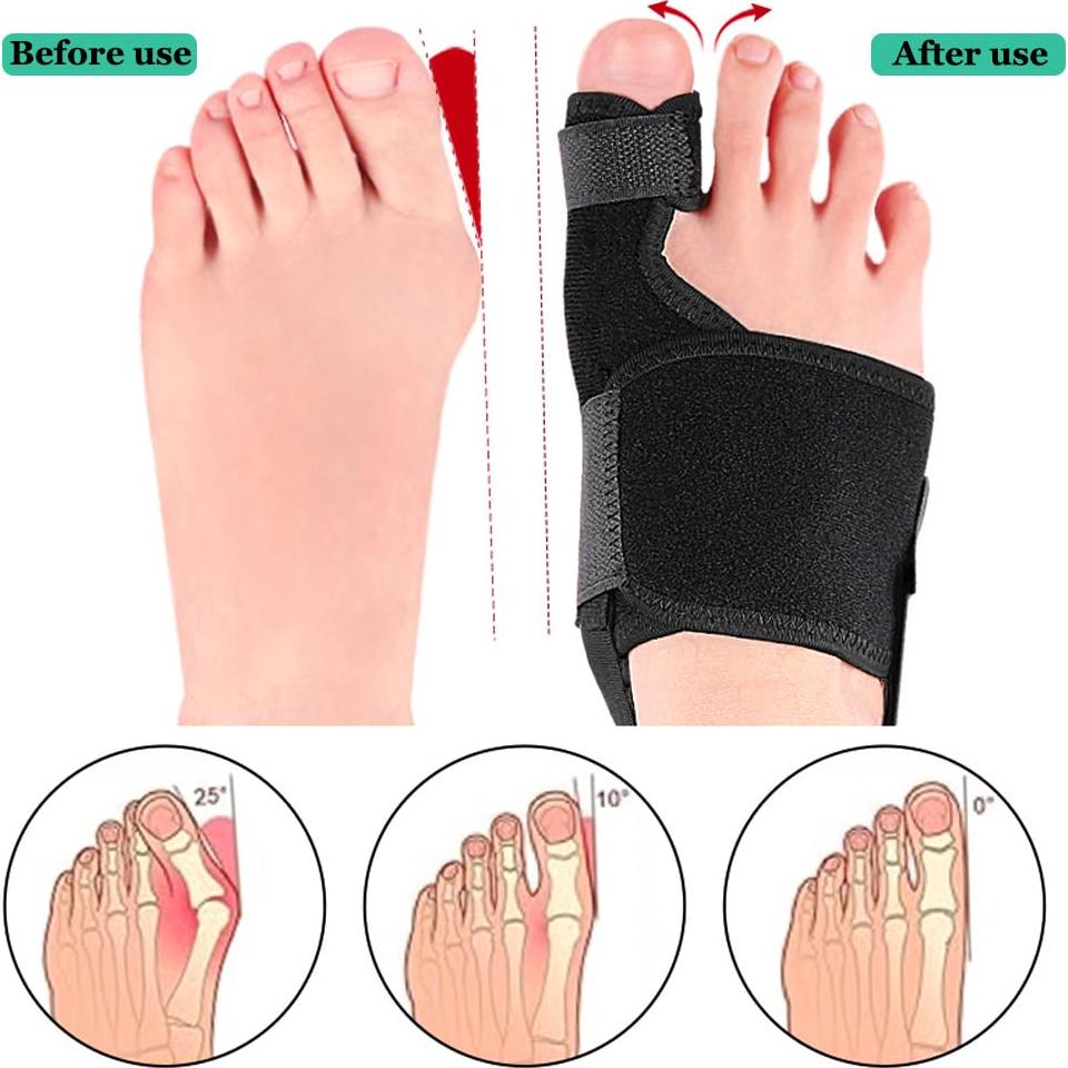 Corrector de Juánete Ortopédico YHOUMEW para Pie Derecho