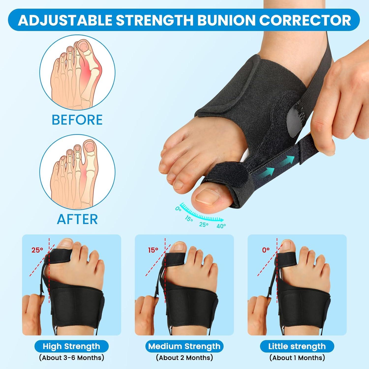 Corrector de Juanetes JNATER - 2 Pcs Ajustable para Alivio