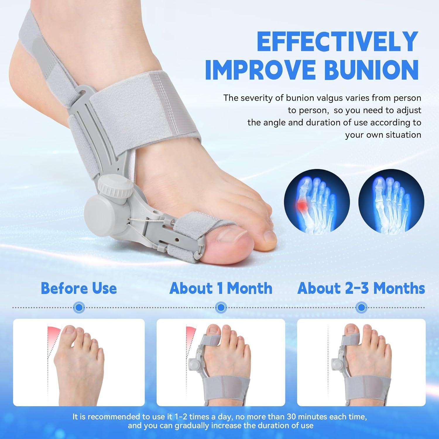 Corrector de Juanetes JUMUR Pie Izquierdo 3 en 1 Alivio