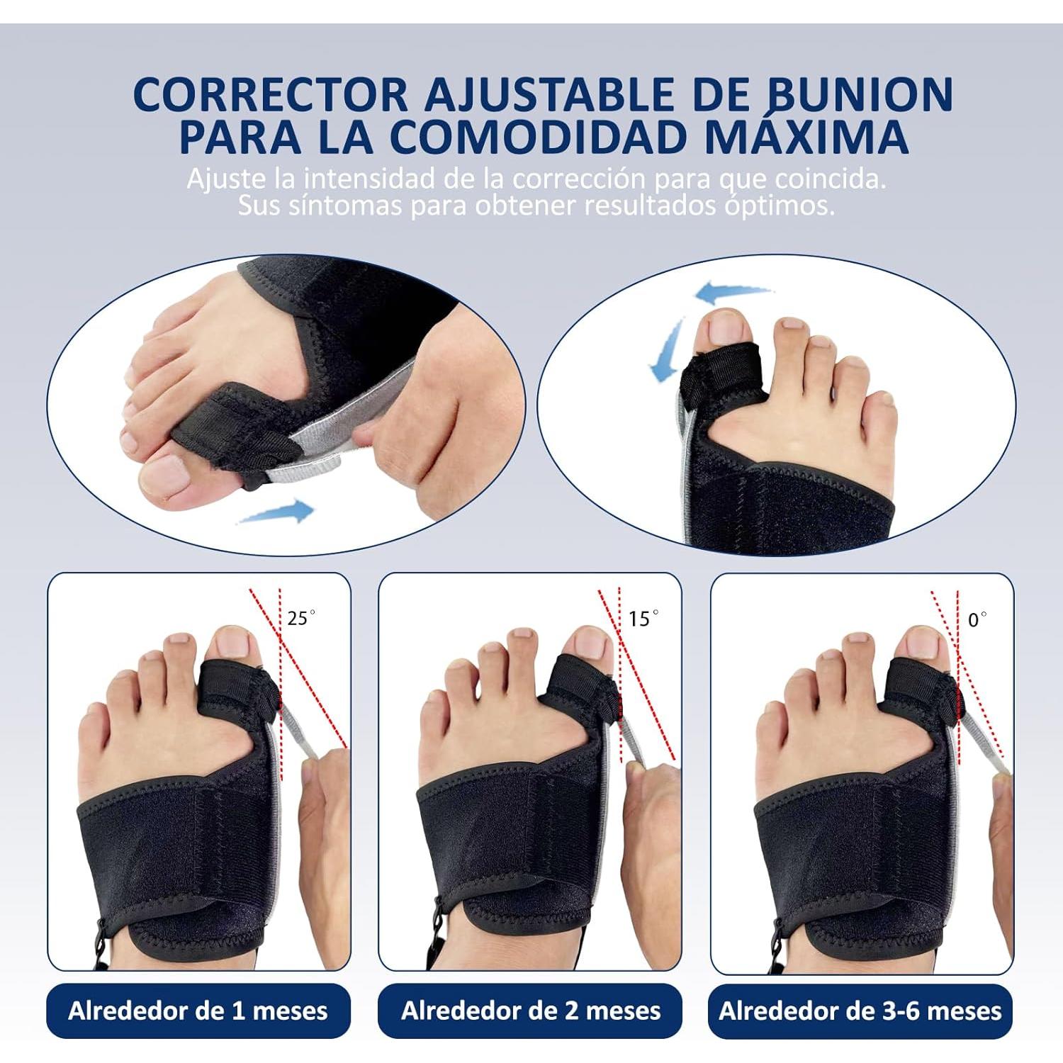 Corrector de Juanetes GIMCALO Ajustable para Alivio del Dolor