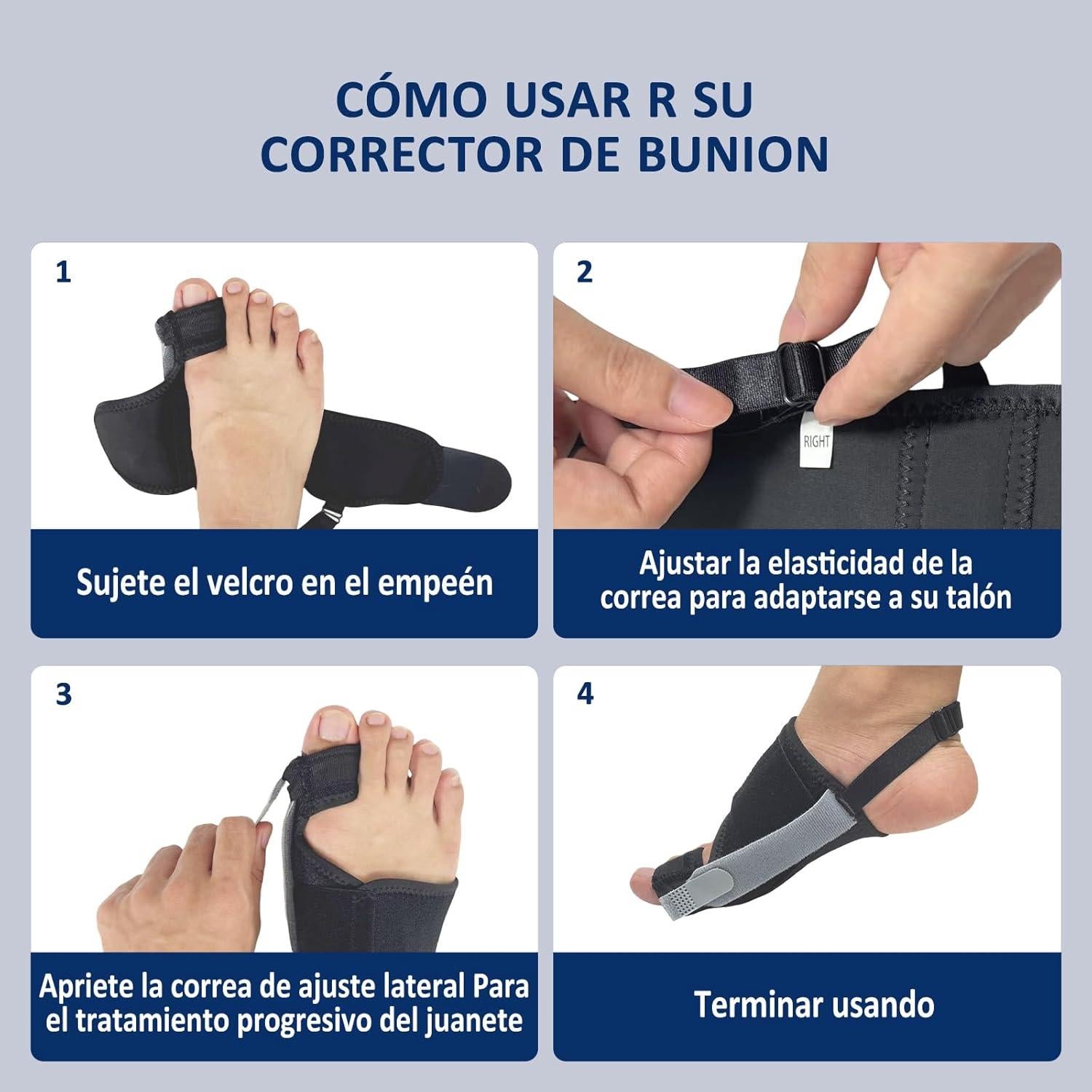 Corrector de Juanetes GIMCALO Ajustable para Alivio del Dolor
