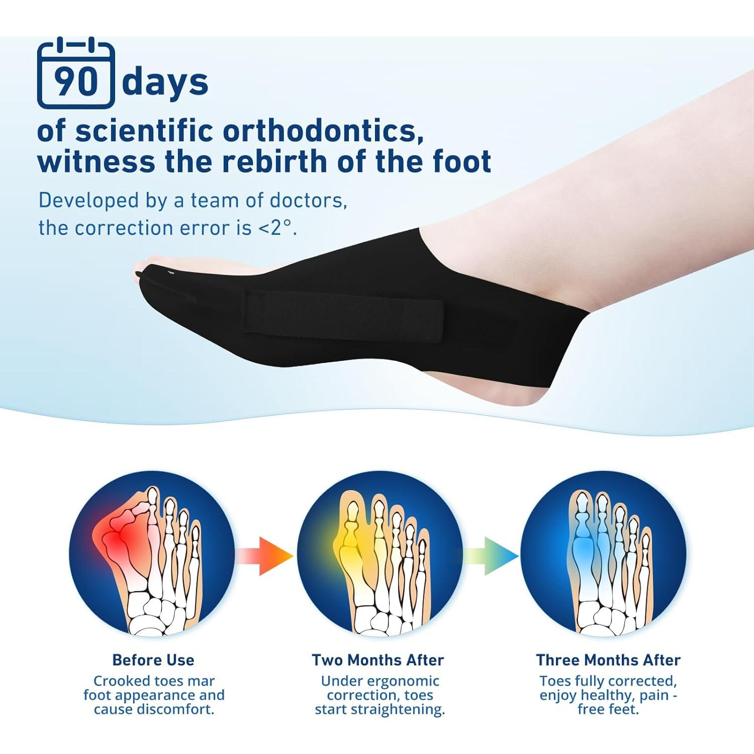 Corrector de Juanetes RUSHFORWARD Ajustable Unisex Negro