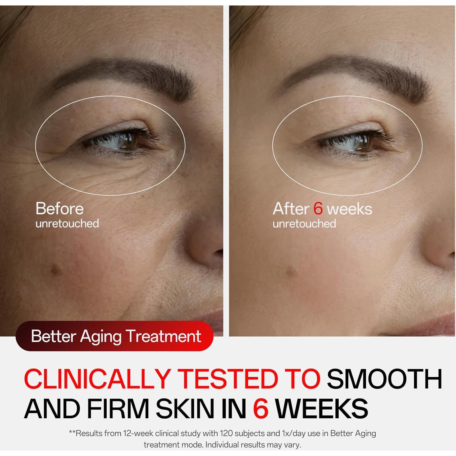 Máscara de Terapia de Luz Roja Facego - Cuidado Facial Portátil