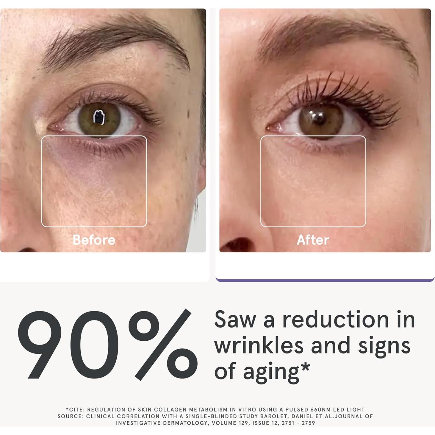 iRestore Máscara de Luz Roja para Ojos - 180 LEDs, Antiarrugas