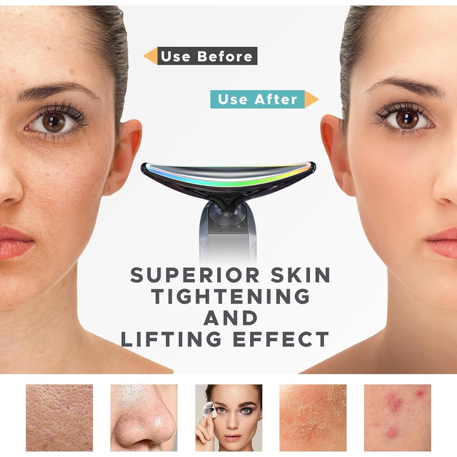 Masajeador Facial y de Cuello Rantxiny con Calor y Vibración