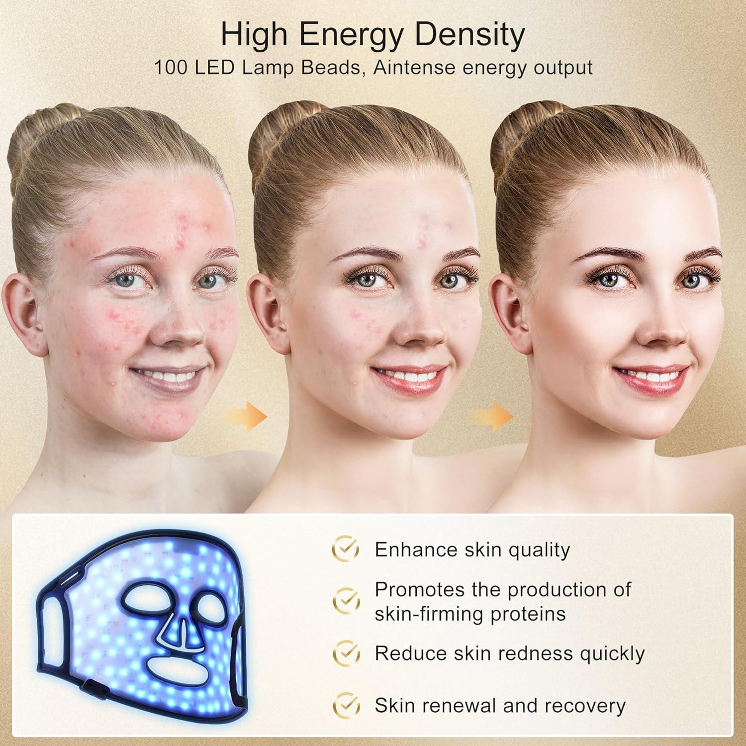 Máscara de Terapia de Luz Roja KINGDO - 4 Modos LED, Portátil