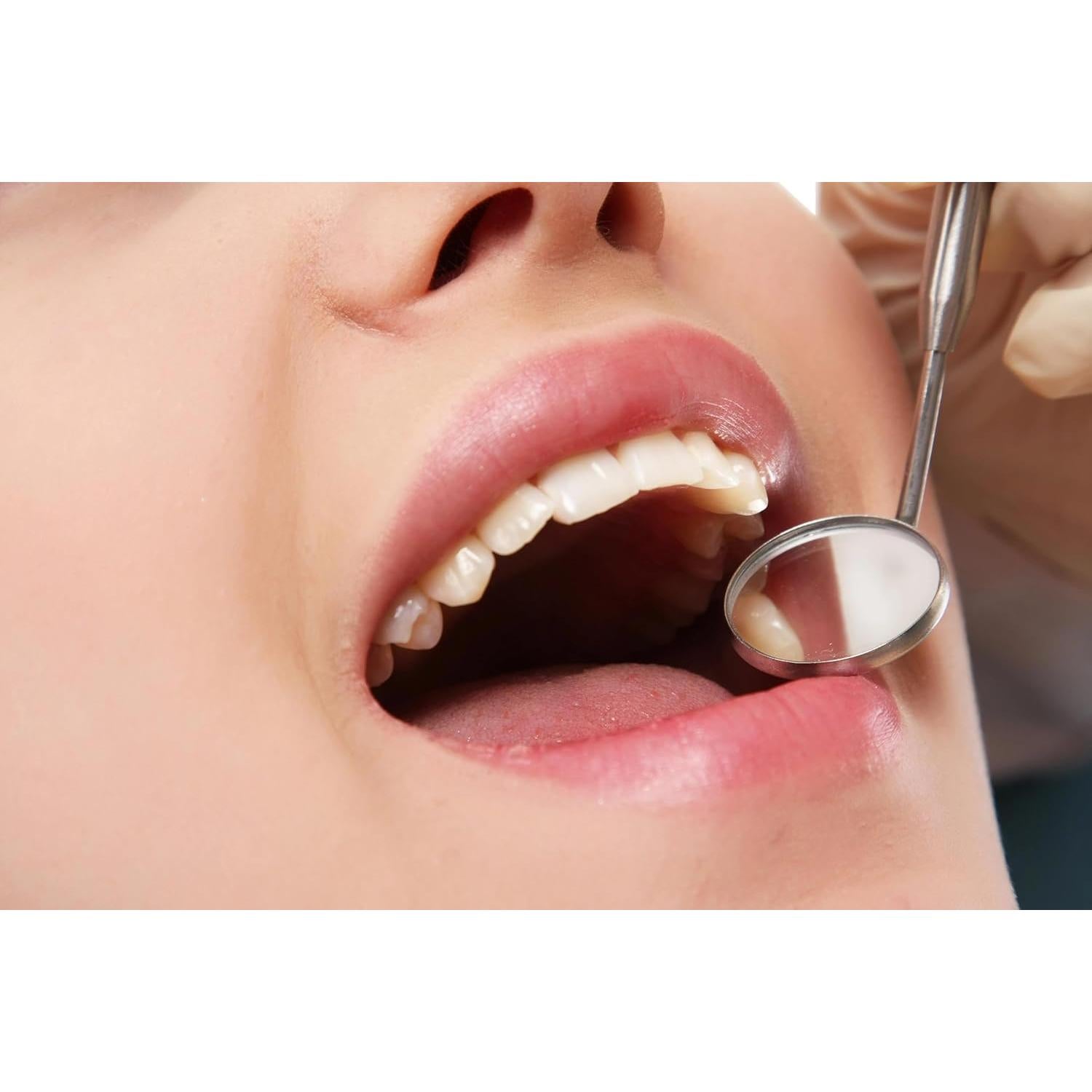 Kit de Limpieza Dental Formit Craft - Raspador, Espejo y Pinzas