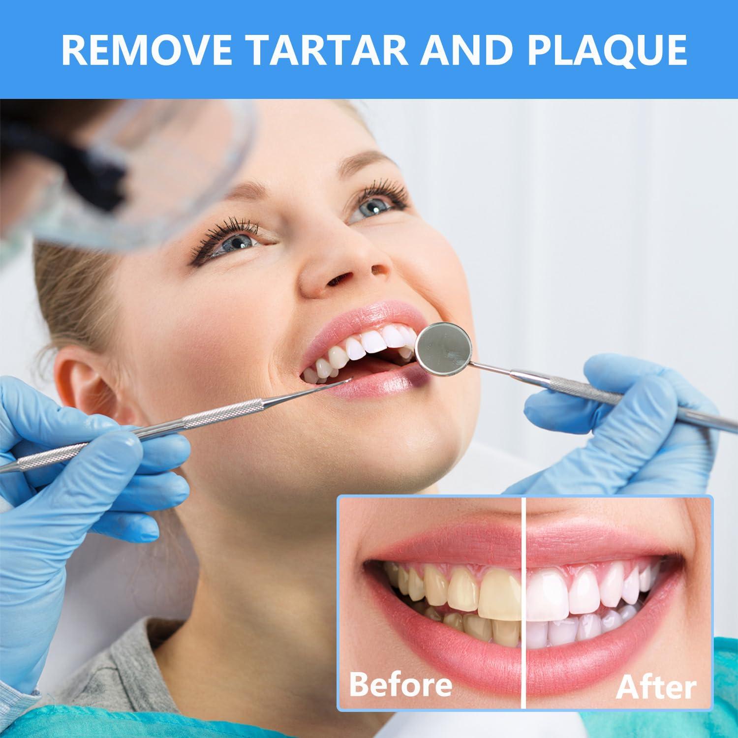 Kit Profesional de Herramientas Dentales SENLMLER - Acero Inoxidable