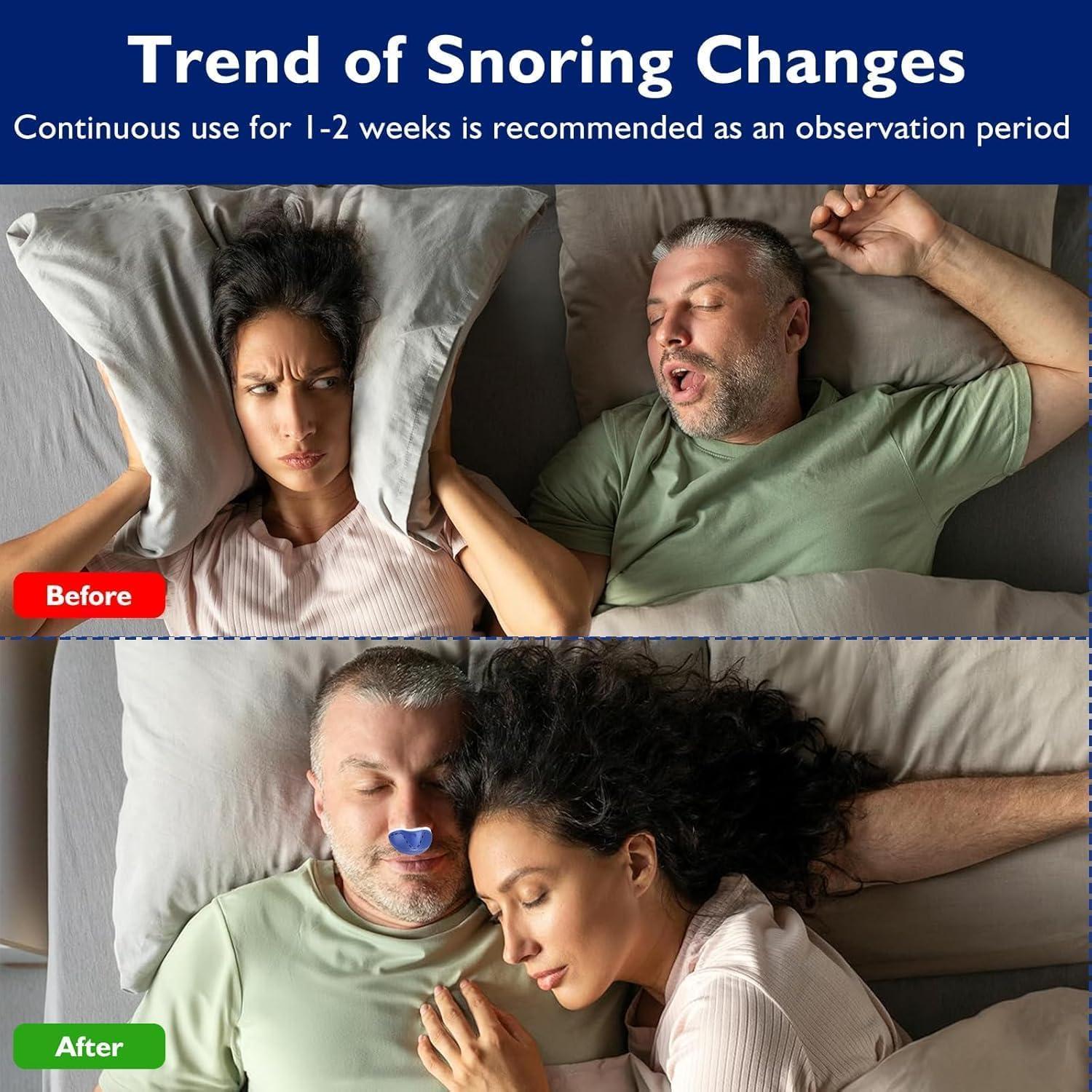 Dispositivo Anti Ronquidos LUNIA - Mini Velocidad Variable - Azul