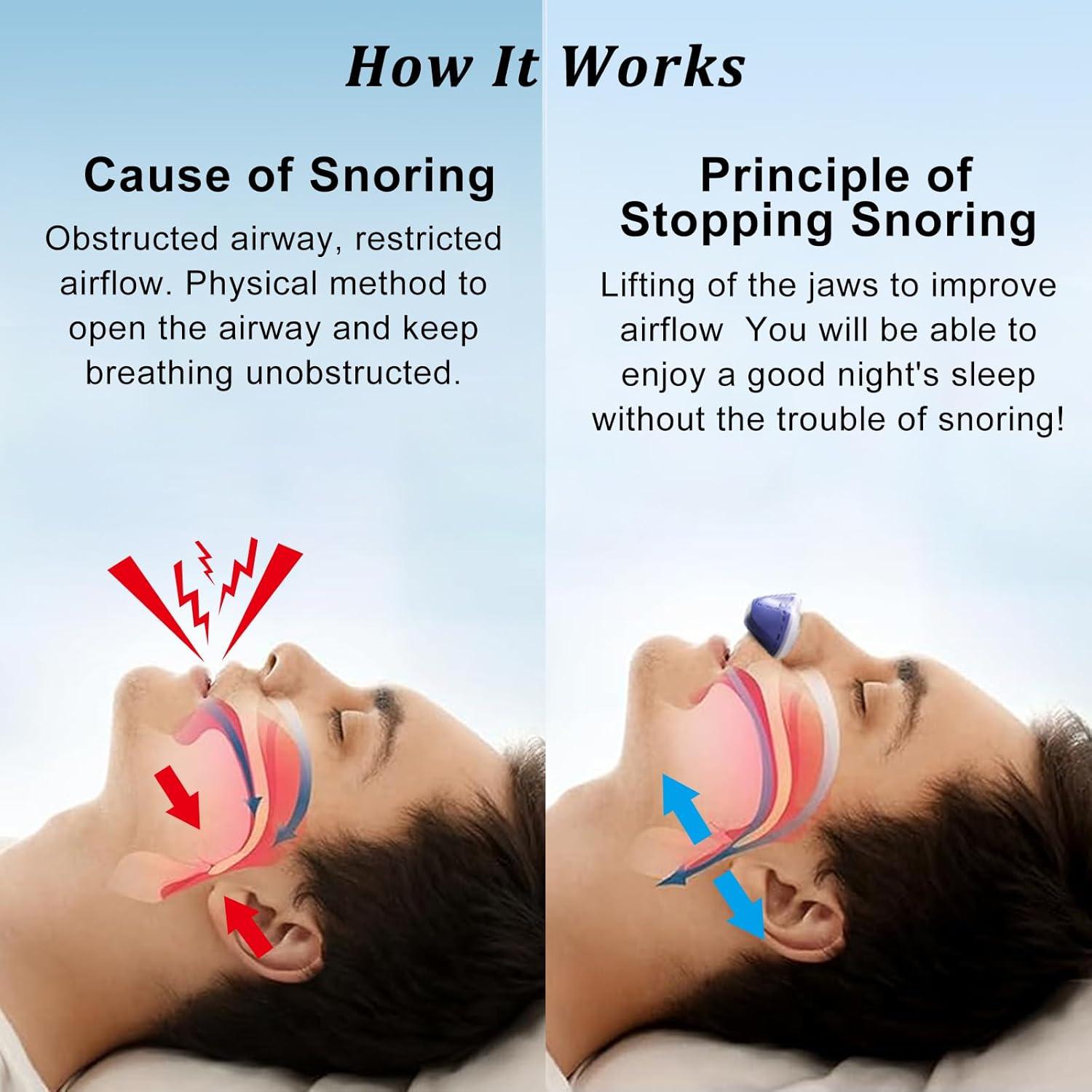 Dispositivo Anti Ronquidos NBF Azul, Carga USB, 3 Velocidades