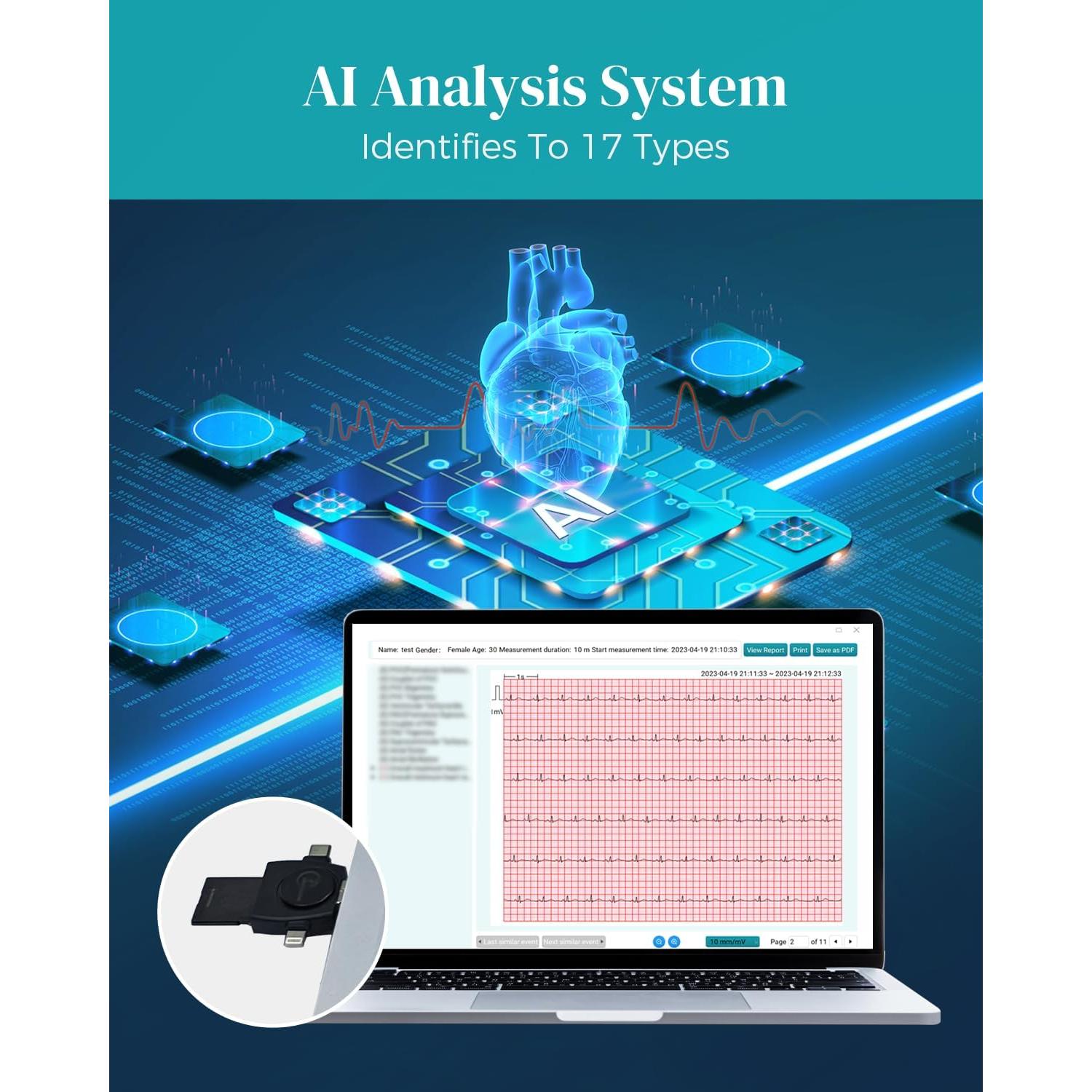 Monitor de Corazón Livenpace TH12 12 Derivaciones 24 Horas