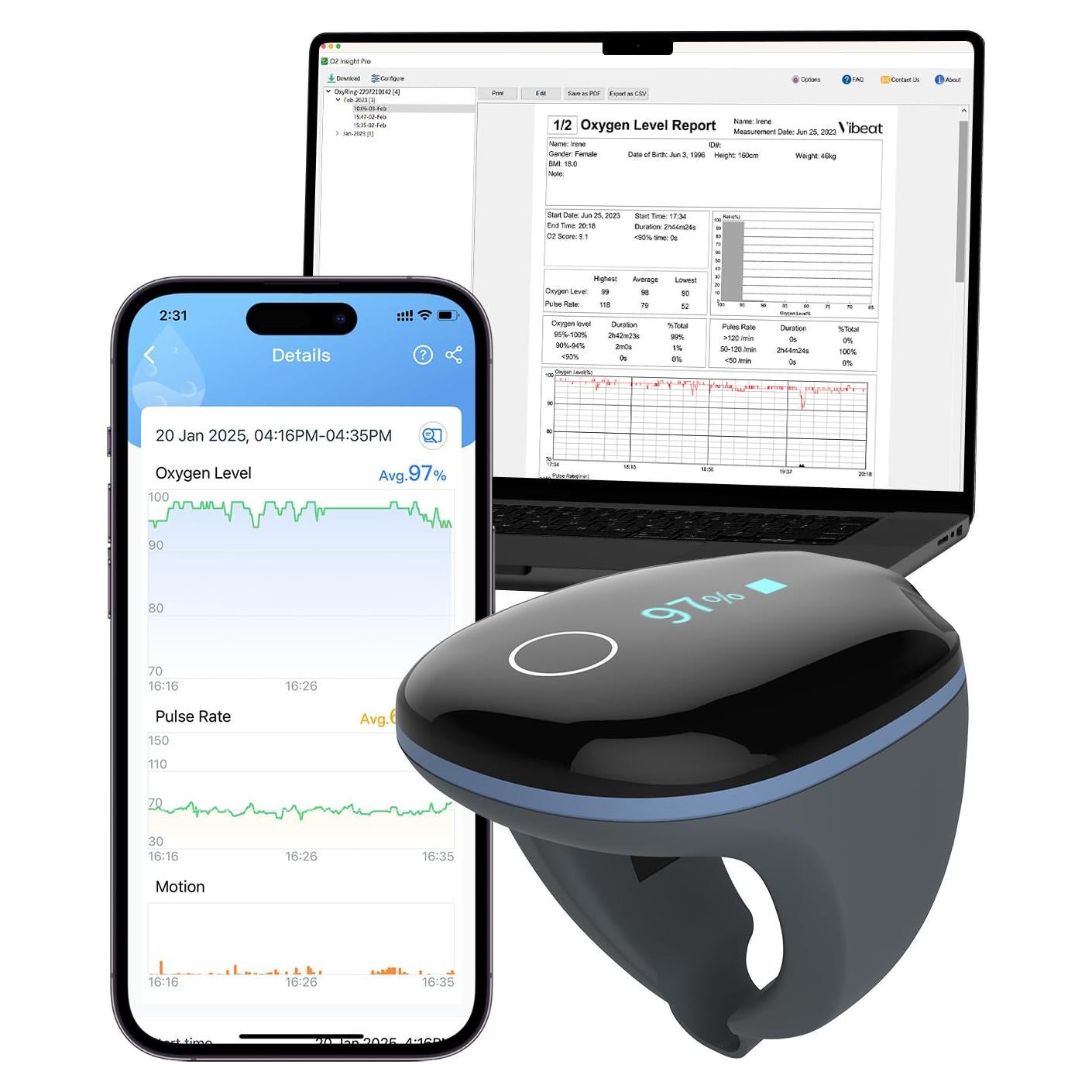 Oxímetro de Pulso Vibeat OxyRing Bluetooth - Monitor de Oxígeno