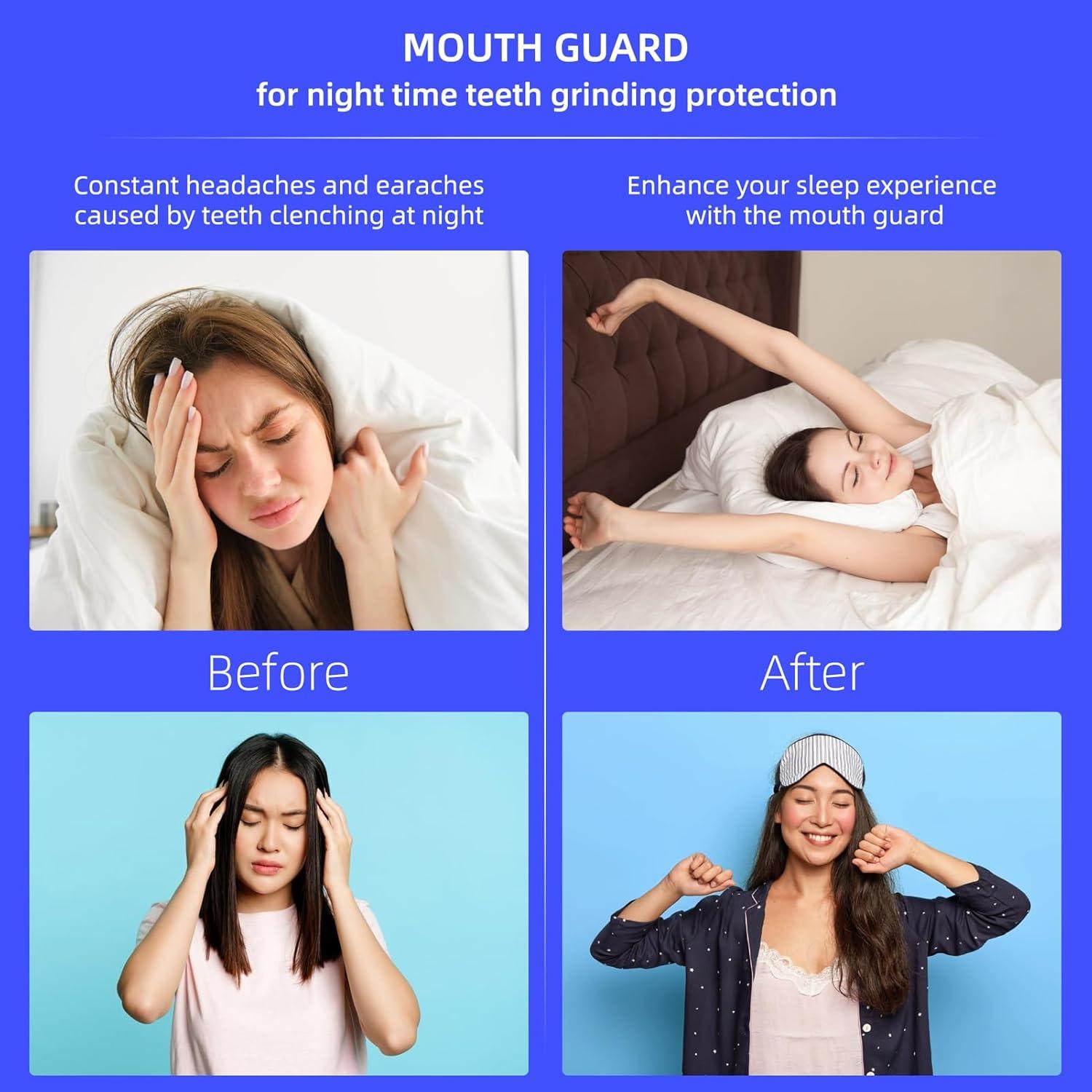 Paquete de 10 Protectores Bucales Moldables Buluoushen para Bruxismo