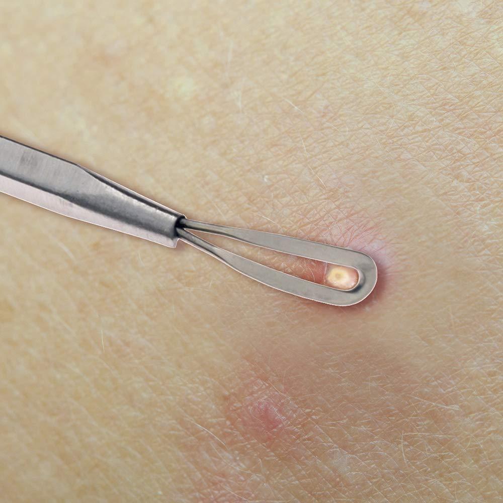 Extractor de Puntos Negros Doble Lazo Beaute Galleria 13cm