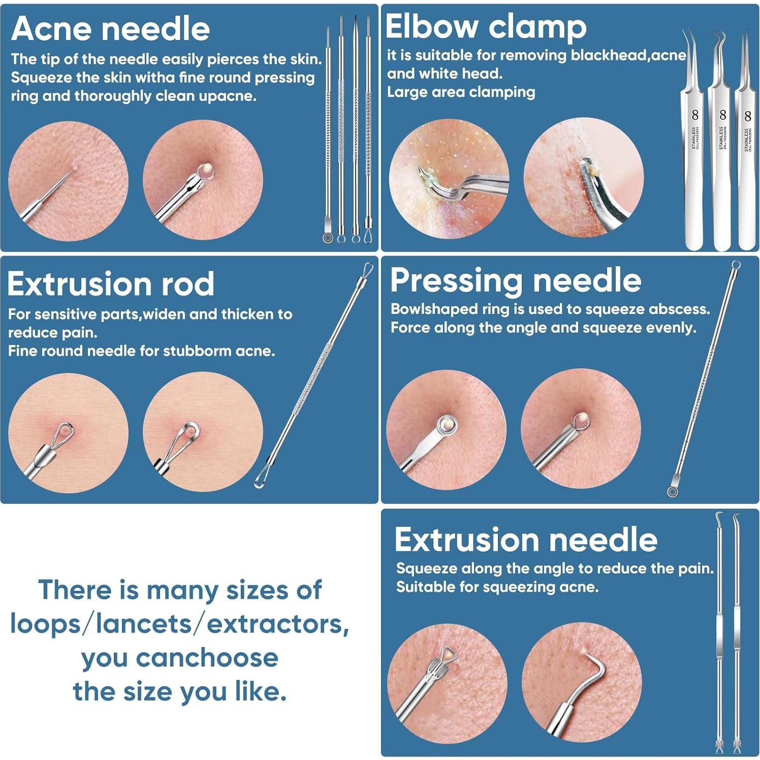 Kit de Herramientas Extractoras de Puntos Negros SBAILL 11PCS