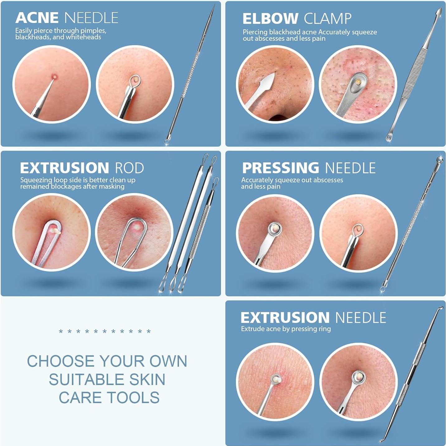 Kit de Herramientas para Extraer Espinillas Teenitor 7 en 1