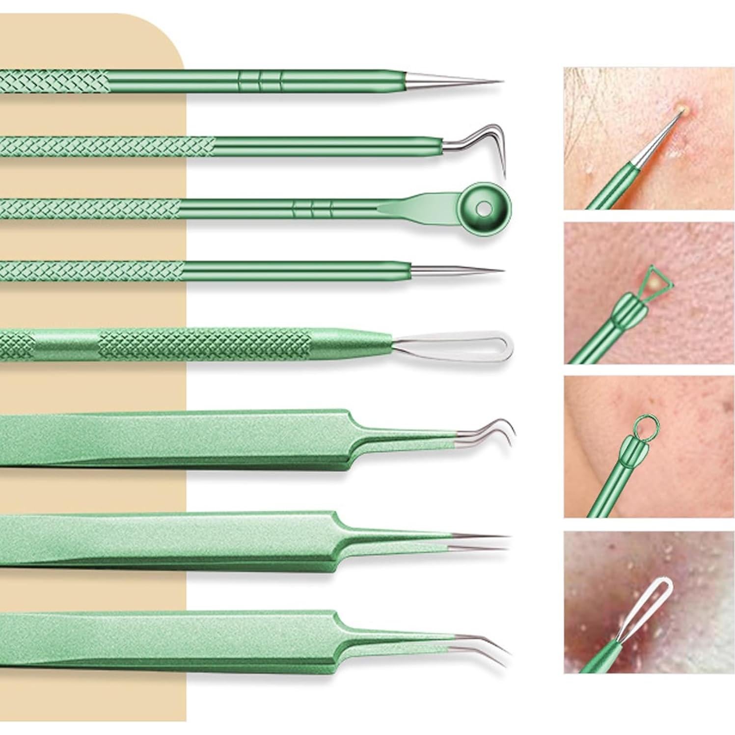 Kit Profesional de Extracción de Espinillas Howinn - 8 Piezas