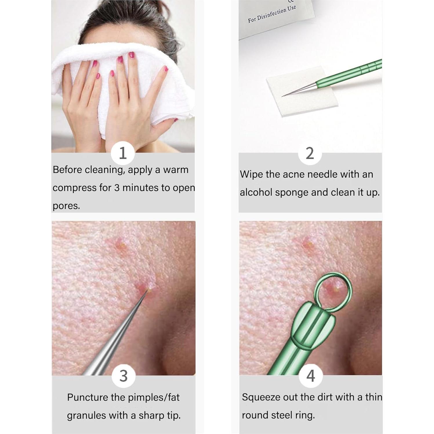 Kit Profesional de Extracción de Espinillas Howinn - 8 Piezas