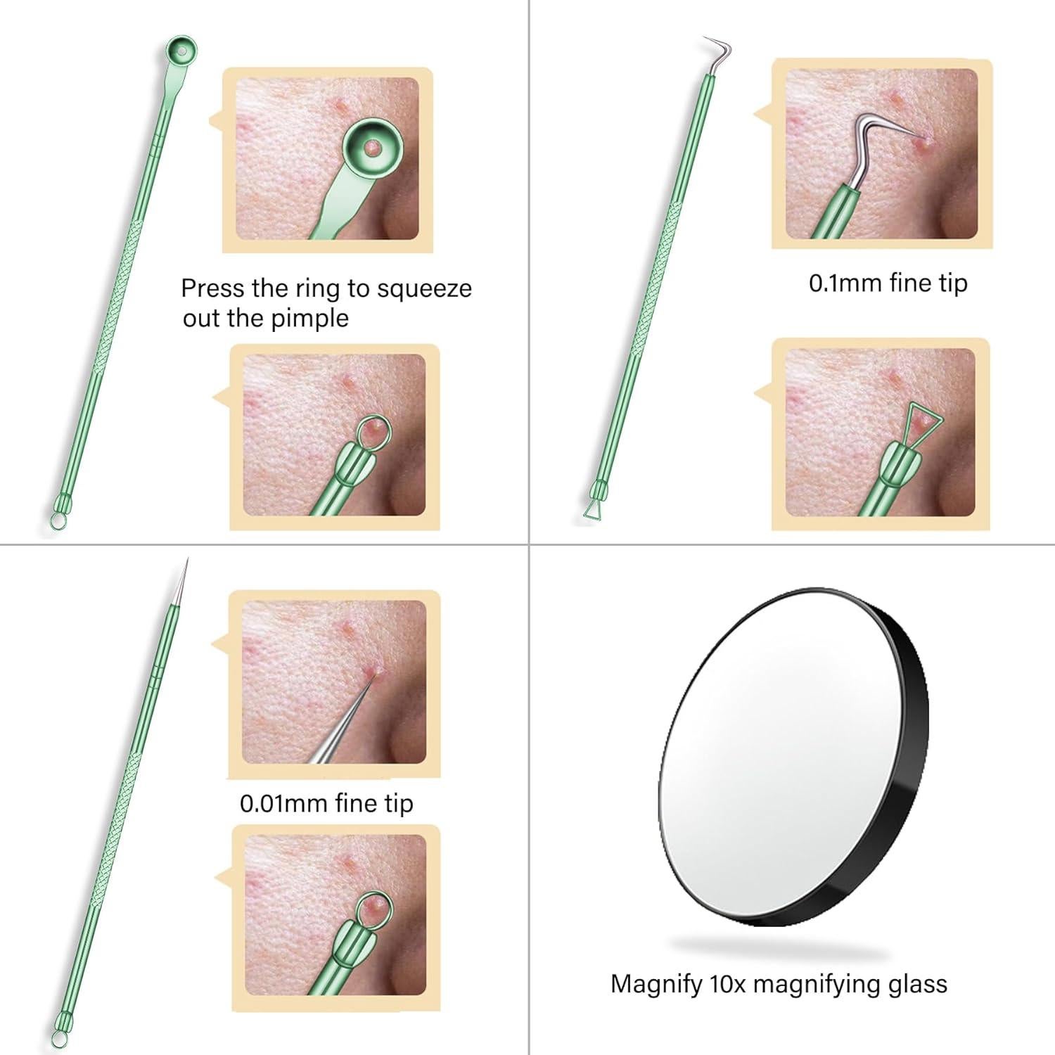 Kit Profesional de Extracción de Espinillas Howinn - 8 Piezas