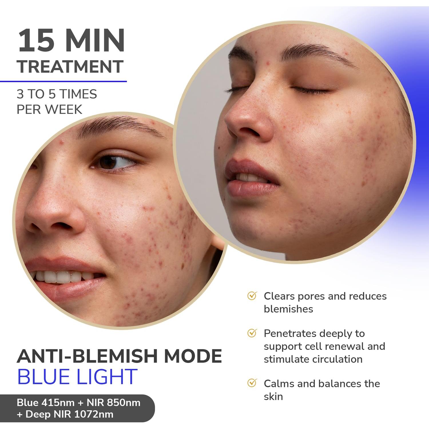 Máscara Facial LED Odelyne Adara Lite con Terapia de Luz