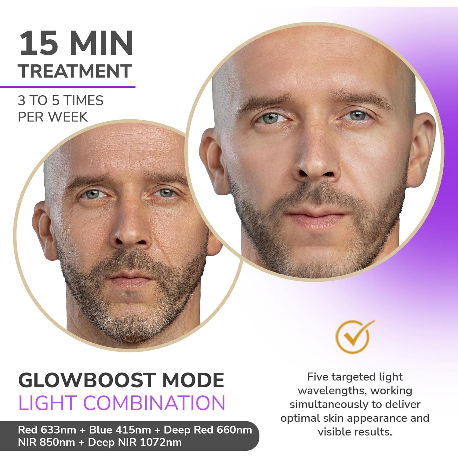 Máscara Facial LED Odelyne Adara Lite con Terapia de Luz