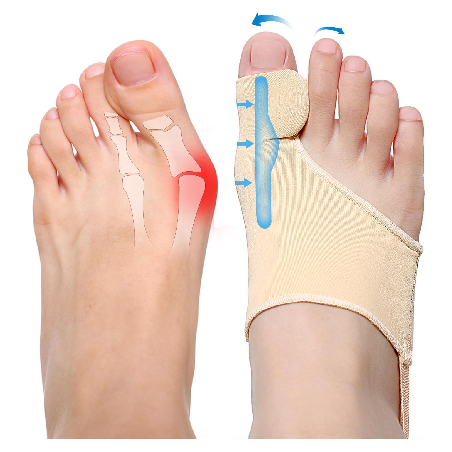 Corrector de Juanetes LEFFIS para Alivio de Hallux Valgus