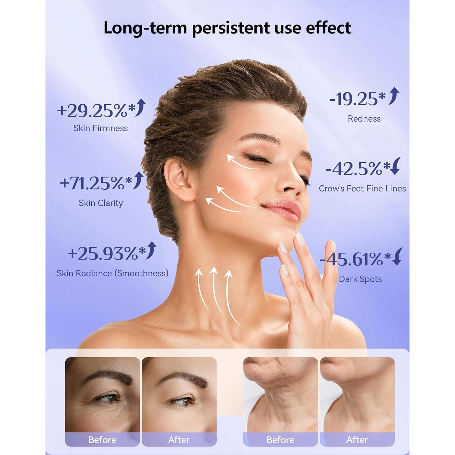 Máscara de Terapia de Luz LED Tinkoola para la Cara 630nm 830nm