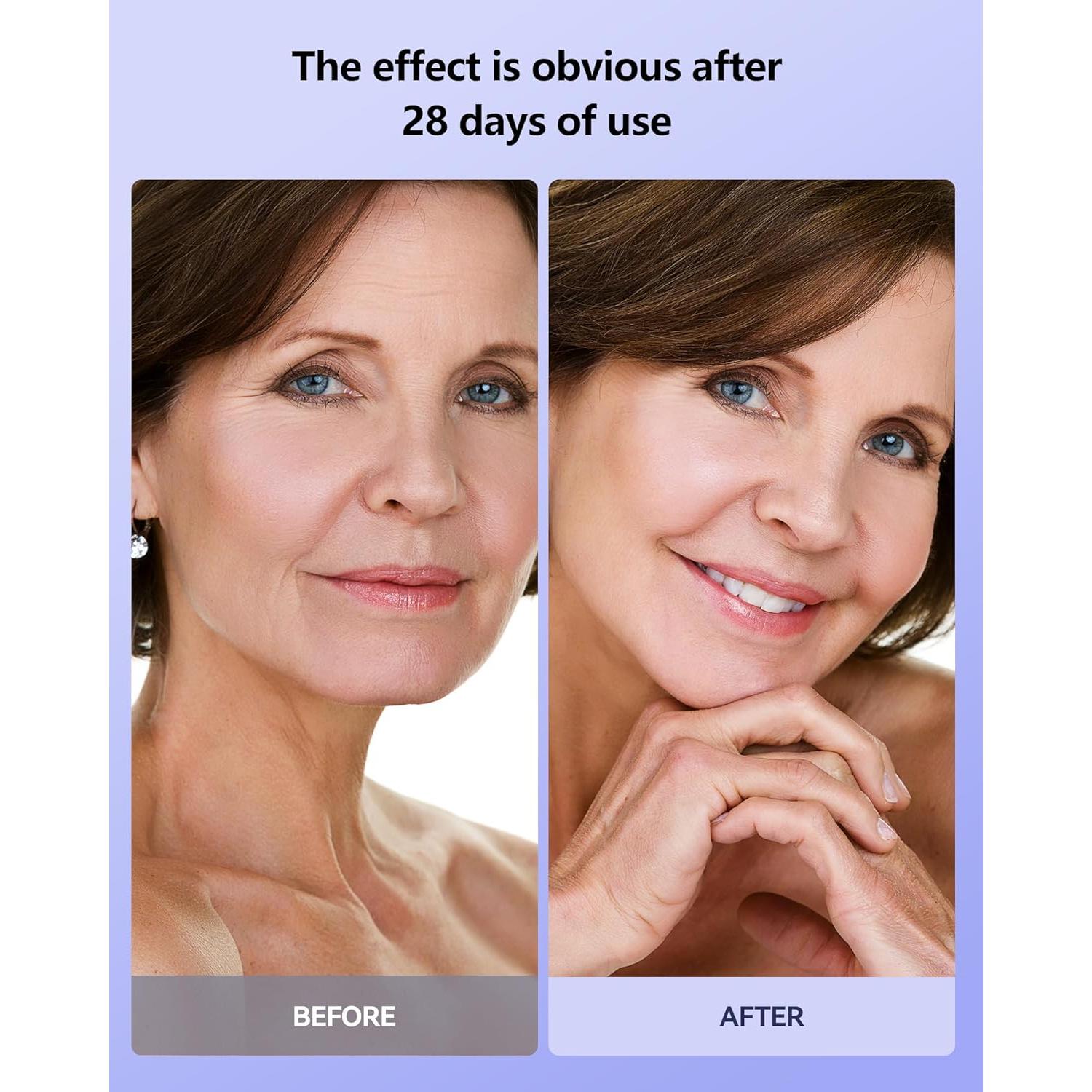 Máscara de Terapia de Luz LED Tinkoola para la Cara 630nm 830nm